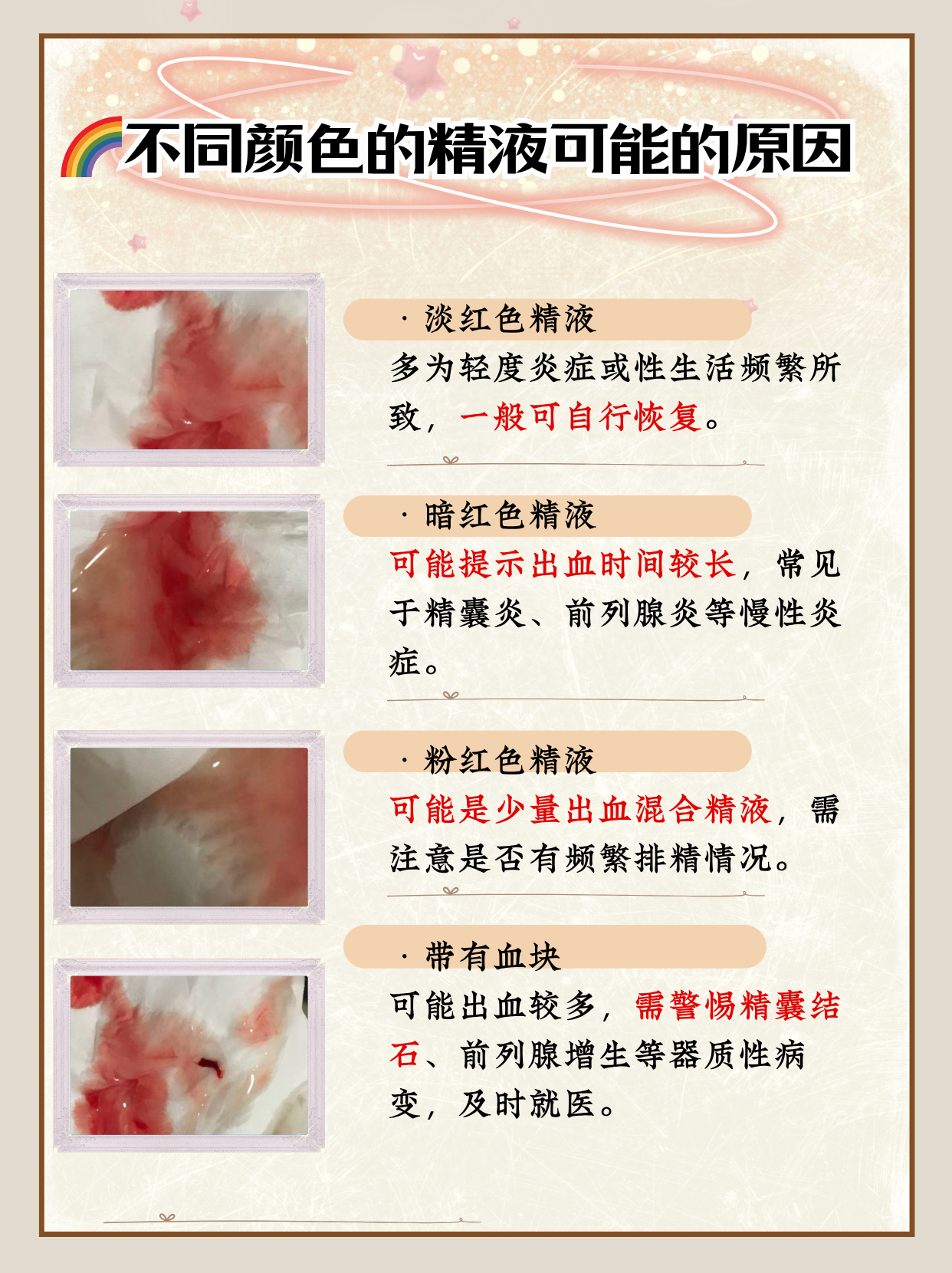 精液里出现血丝让人既担心又尴尬