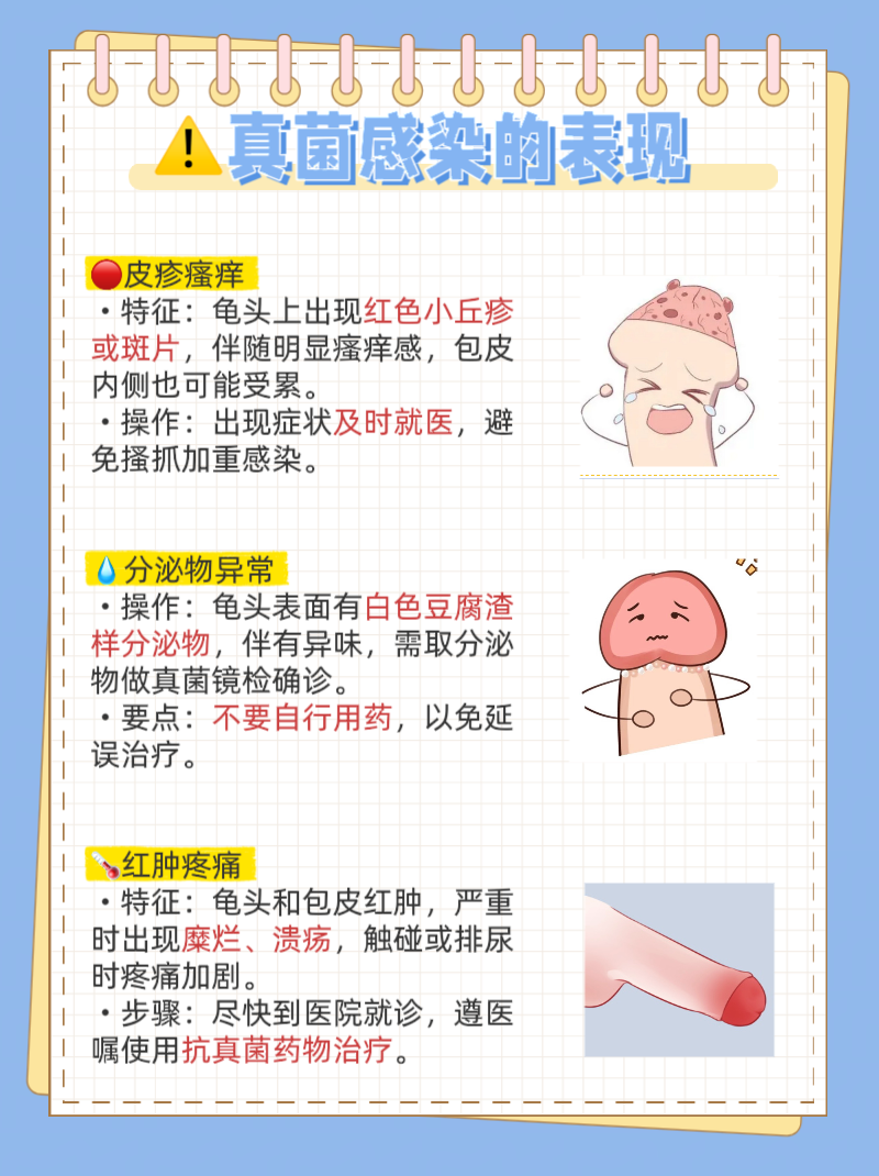 男性龟头出现真菌感染别慌张,了解这些原因才能