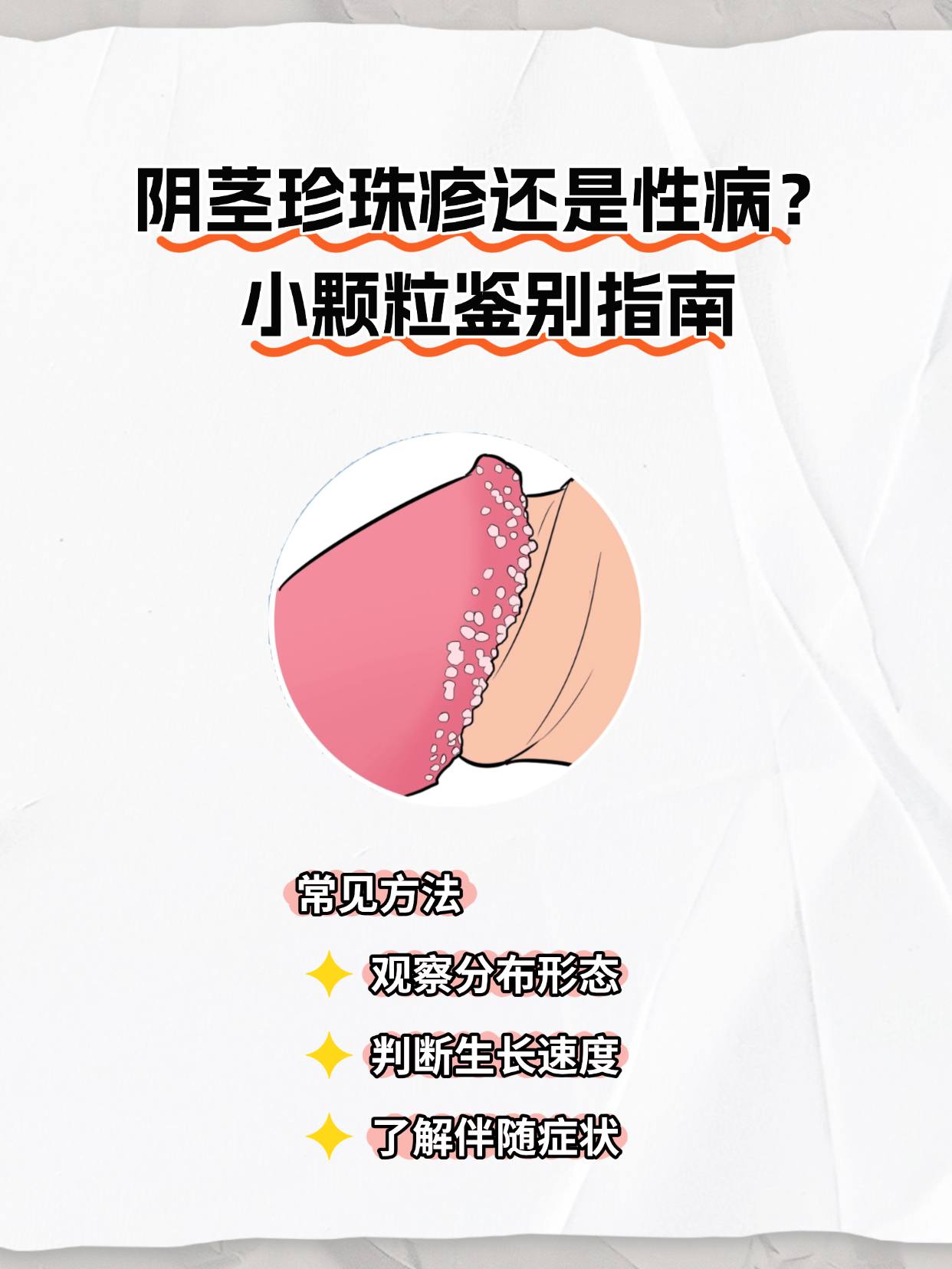 阴茎珍珠疹多沿男性湿锐疣早期图片和珍珠疹区别珍珠状丘疹图片男男性