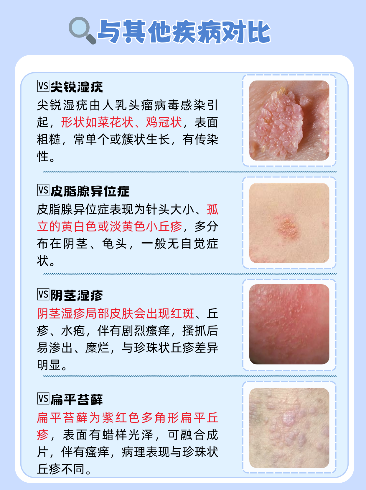 发现阴茎上出现小丘疹,不少男性会感到惊慌,担心是严重