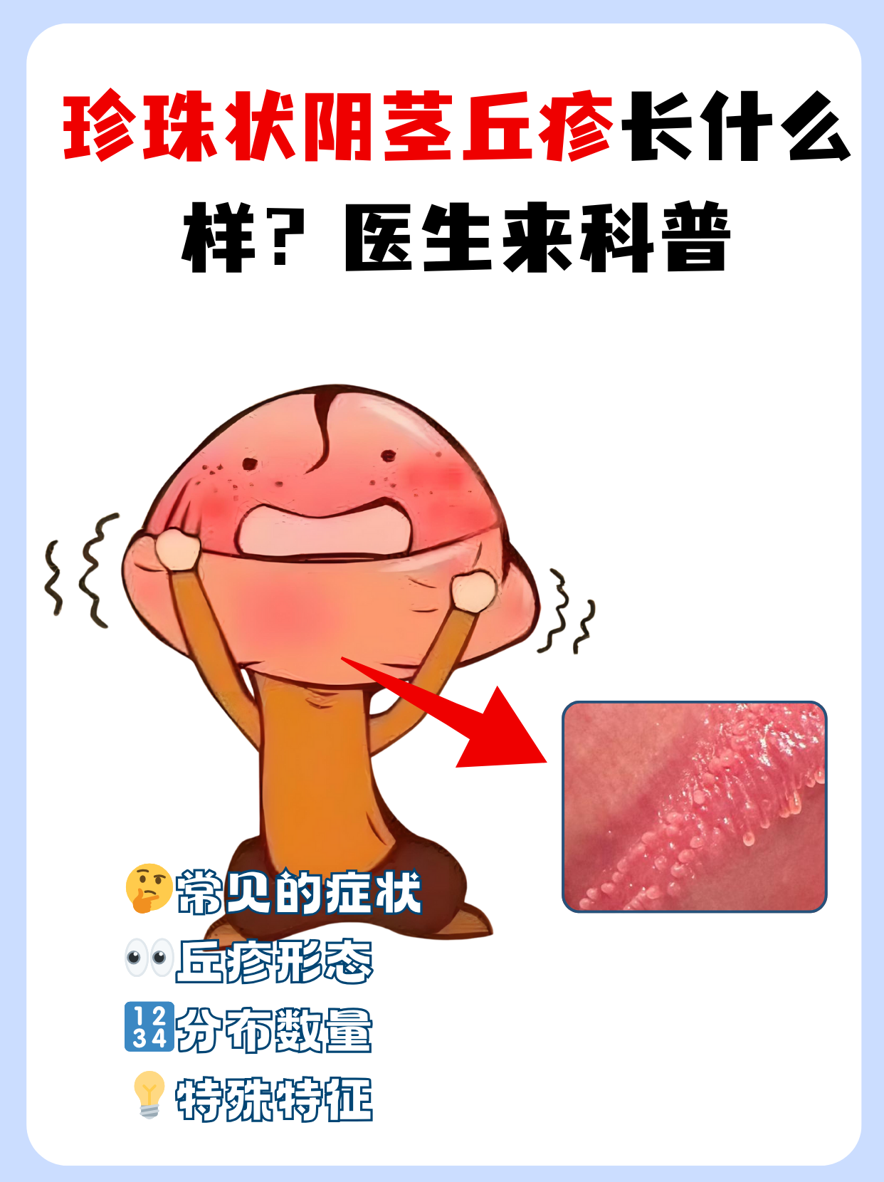 发现阴茎上出现小丘疹,不少男性会感到惊慌,担心是严重