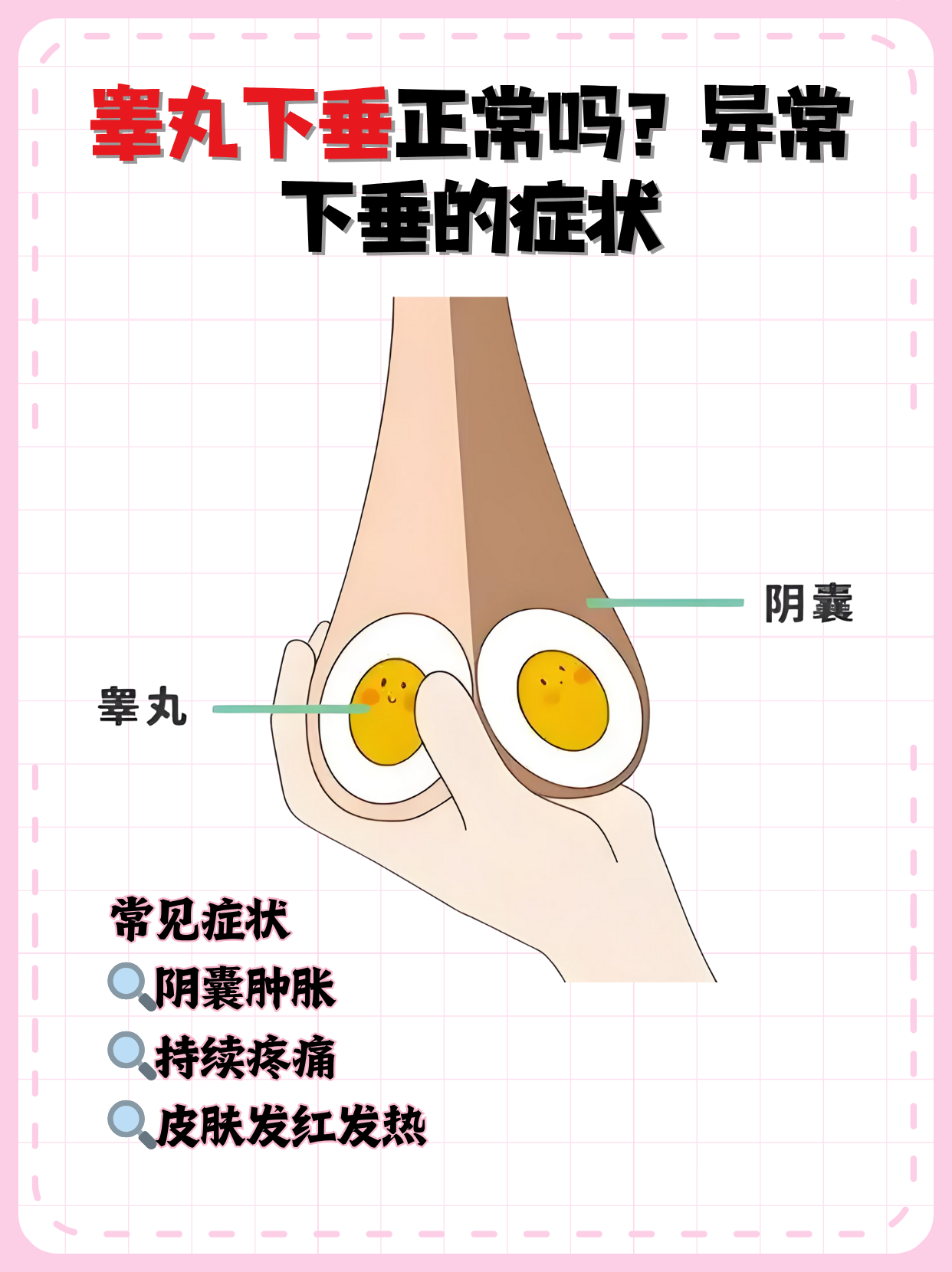 正常情况下,阴囊会随温度变化调节位置,但若出现持续下垂伴红肿,疼痛