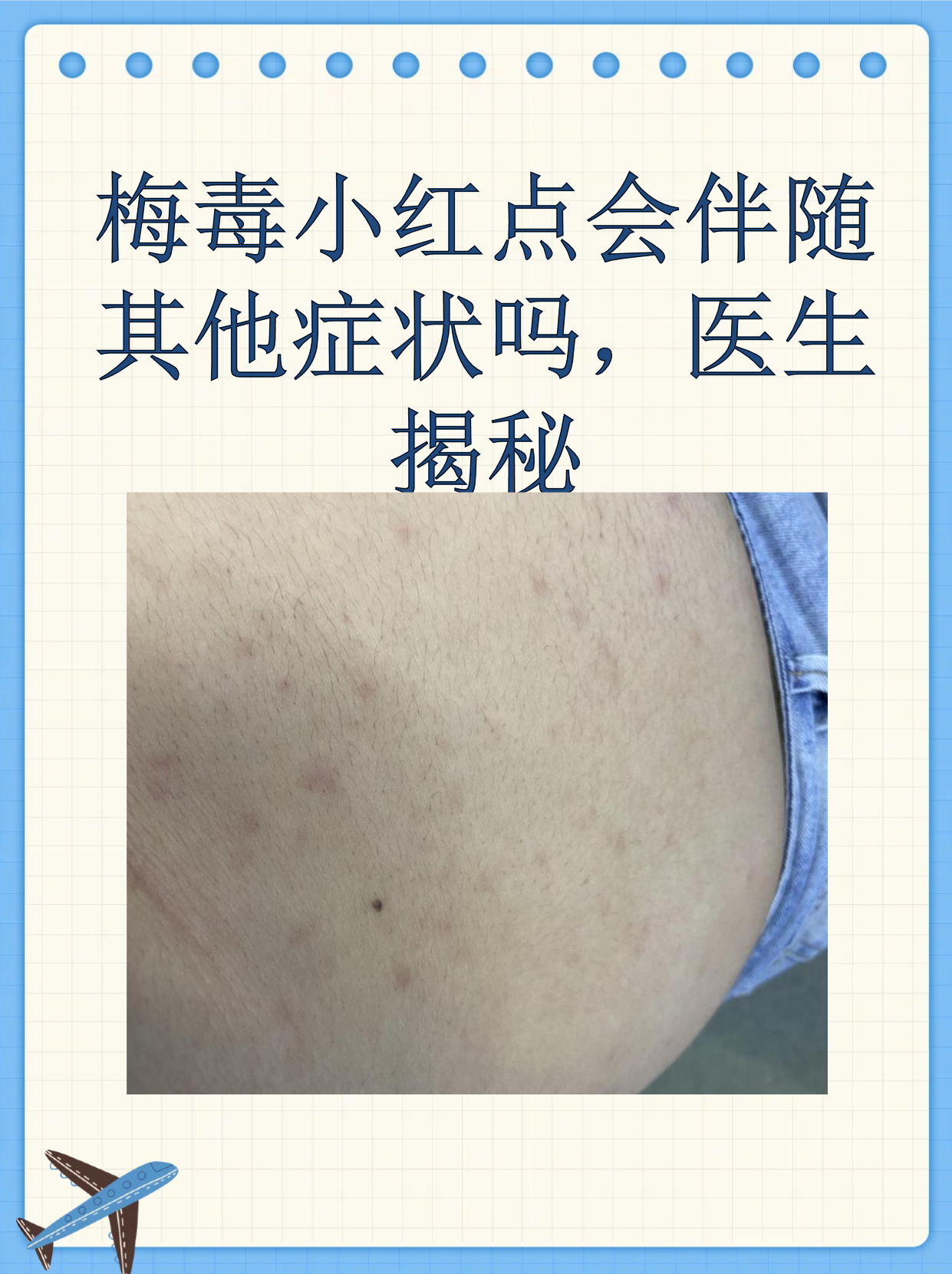 梅毒小红点会伴随其他症状吗,医生揭秘
