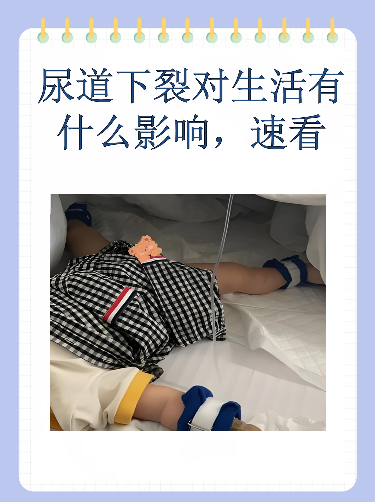 尿道下裂对生活有什么影响,速看