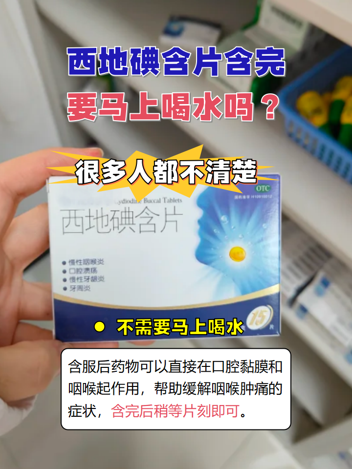 西地碘含片是一种常见的口腔治疗药物
