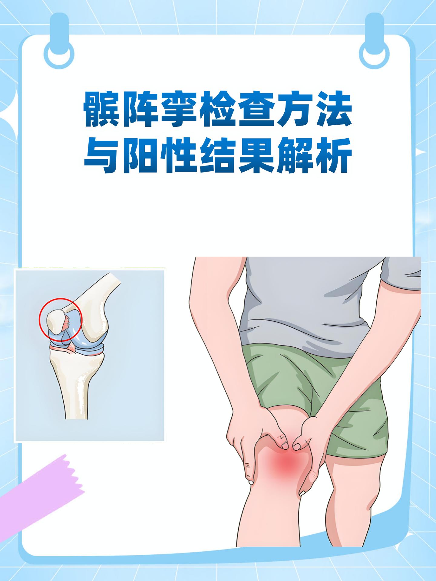 [疑问] 你是否在体检或医疗检查中听说过"髌阵挛"?