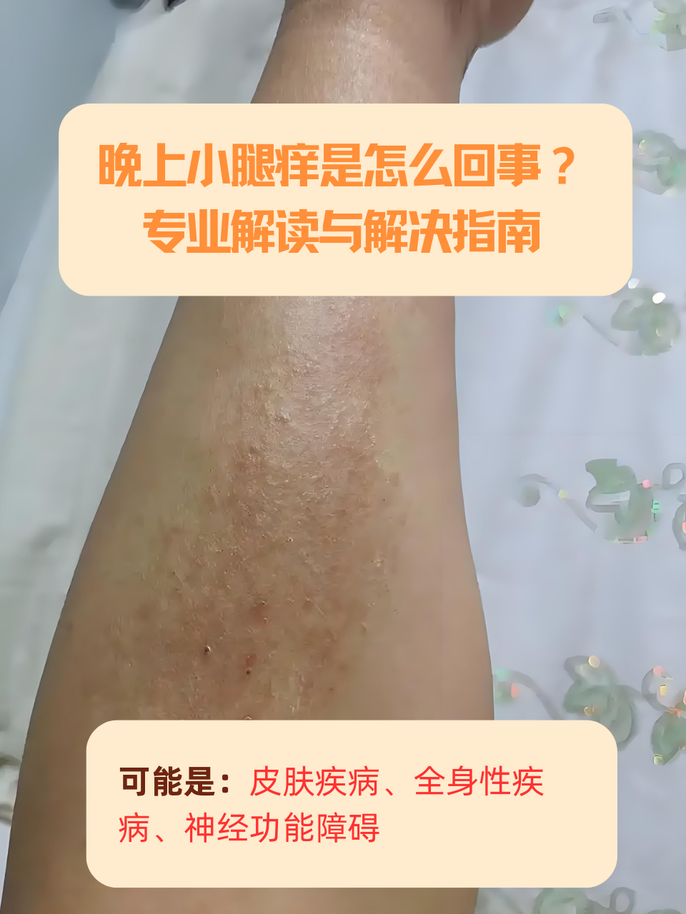 为什么晚上睡觉皮肤痒 为什么晚上睡觉皮肤痒