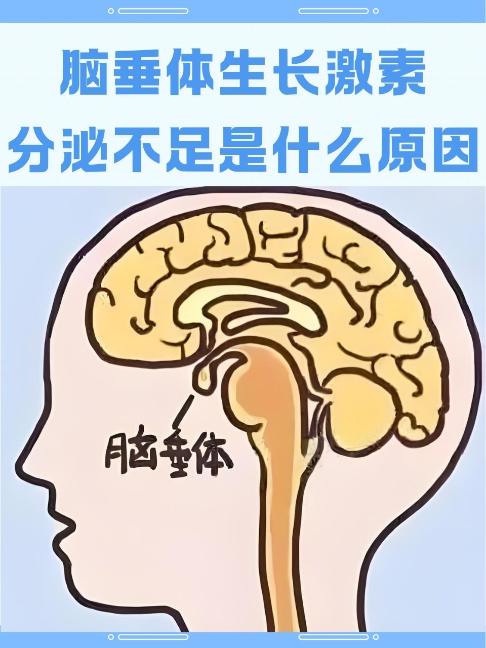 脑垂体生长激素分泌不足是什么原因