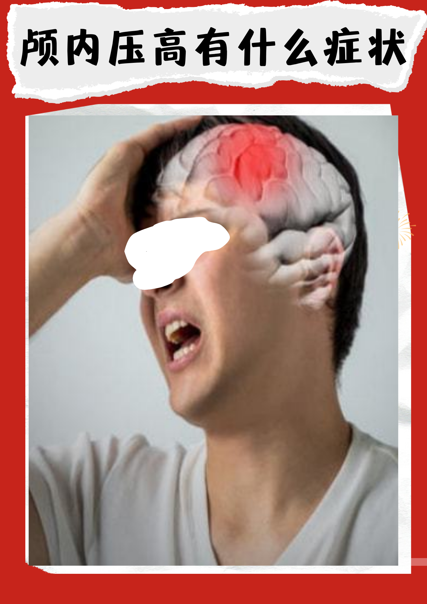 颅内压高是一种较为严重的病症,对患者的健康