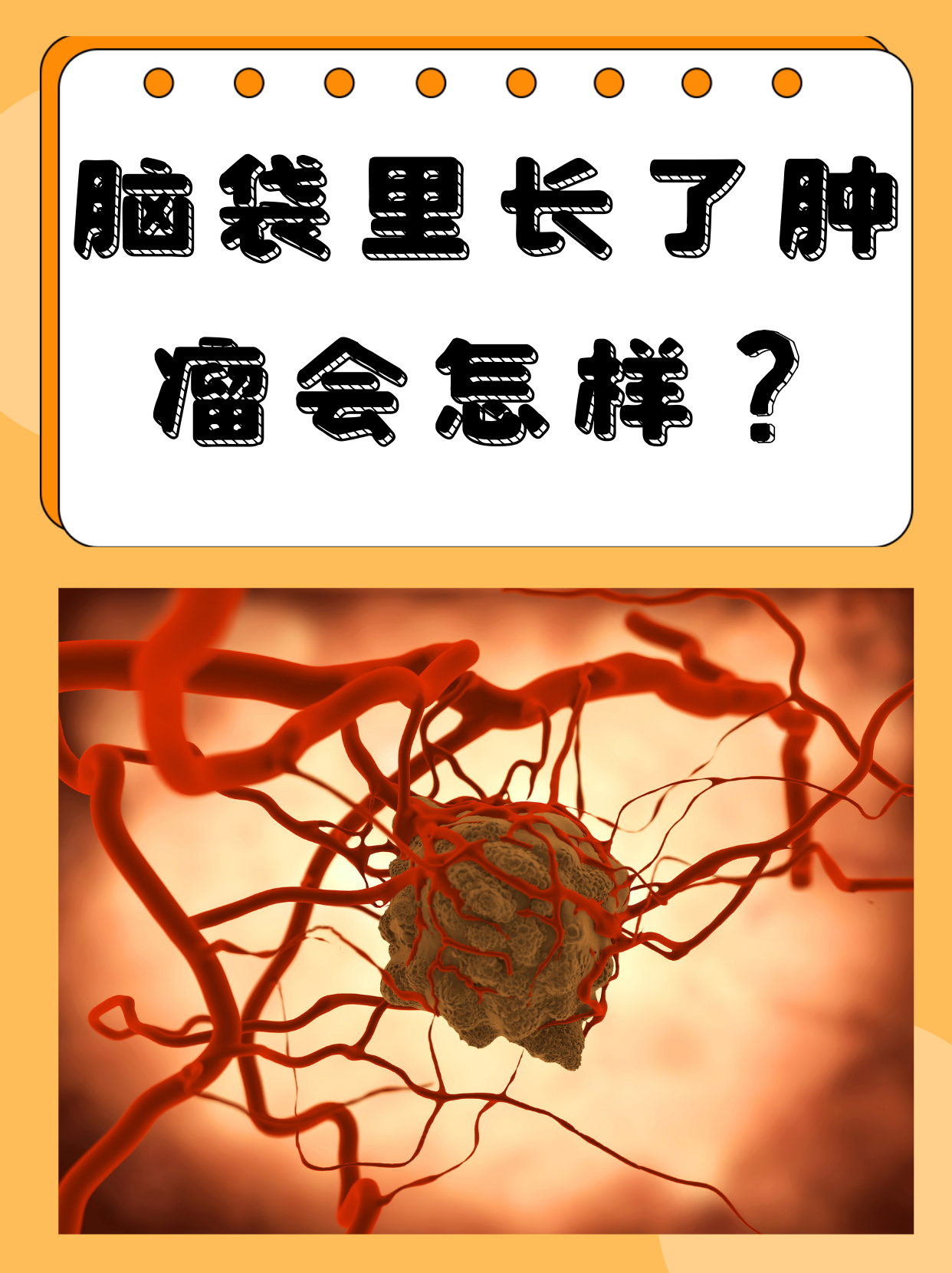脑袋作为人体的"指挥中心",一旦里面长了肿瘤,无疑会给患者带来巨大