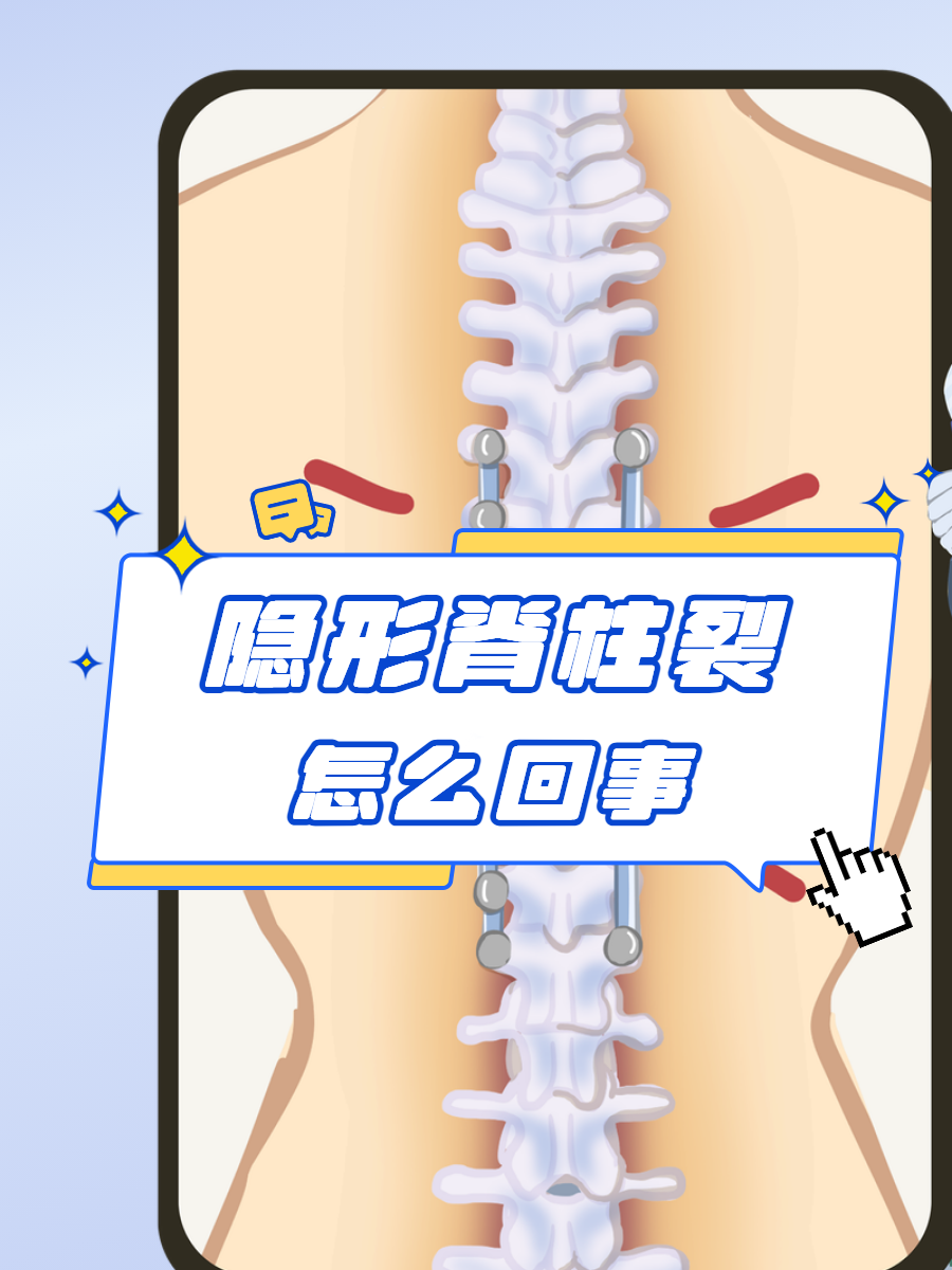 隐形脊柱裂怎么回事?