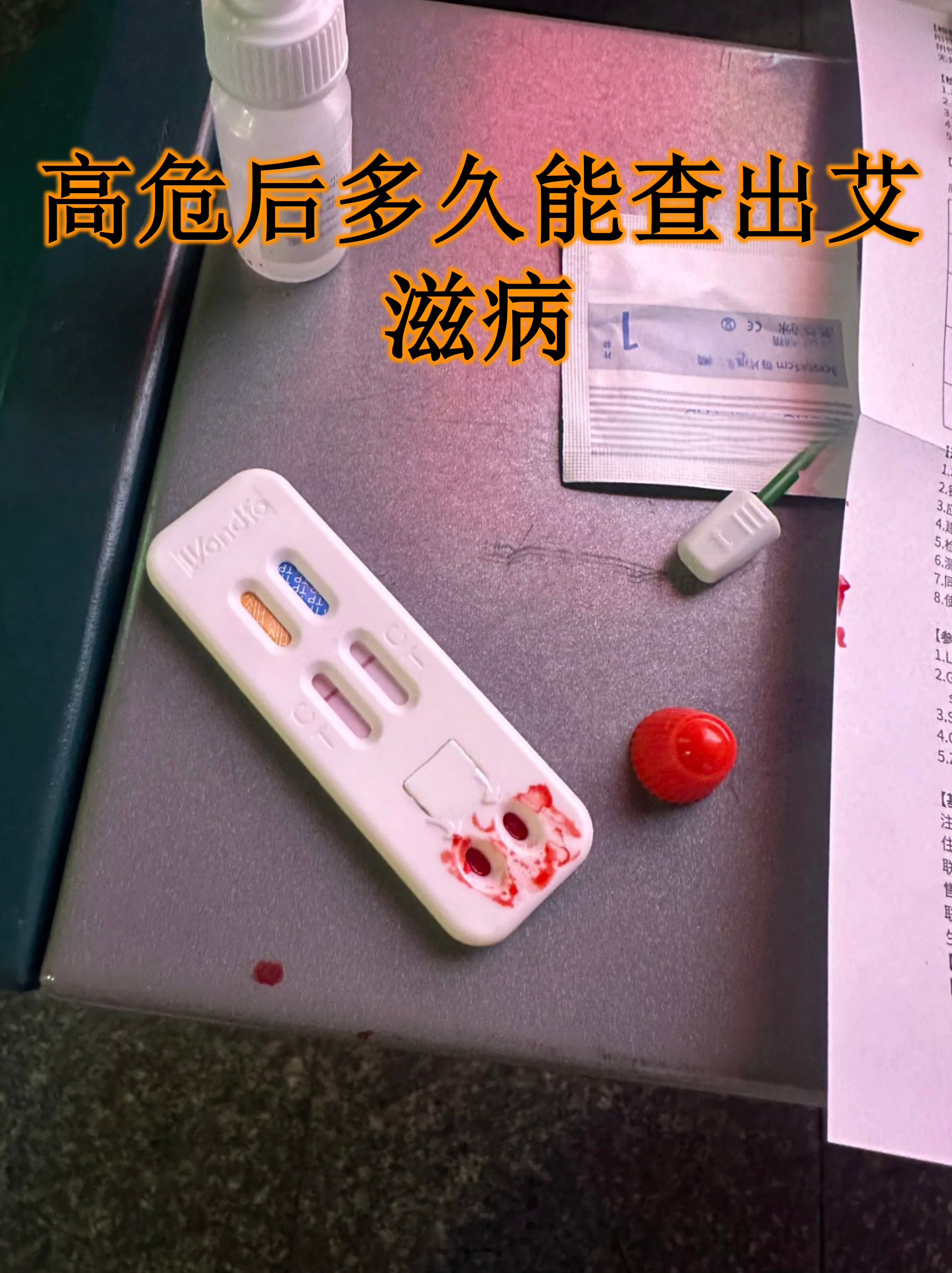 高危后多久能查出艾滋病