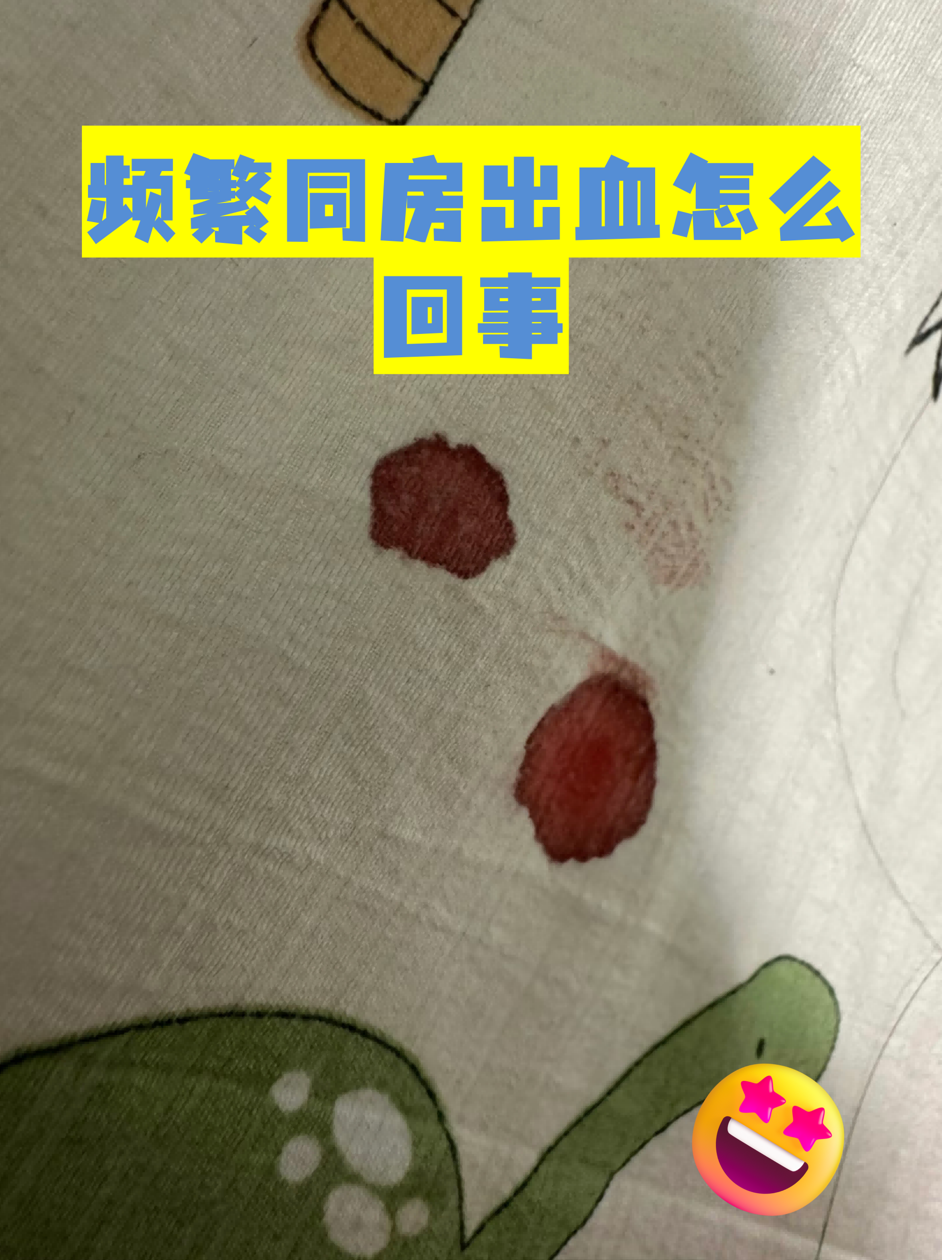 为什么行房的时候会出血