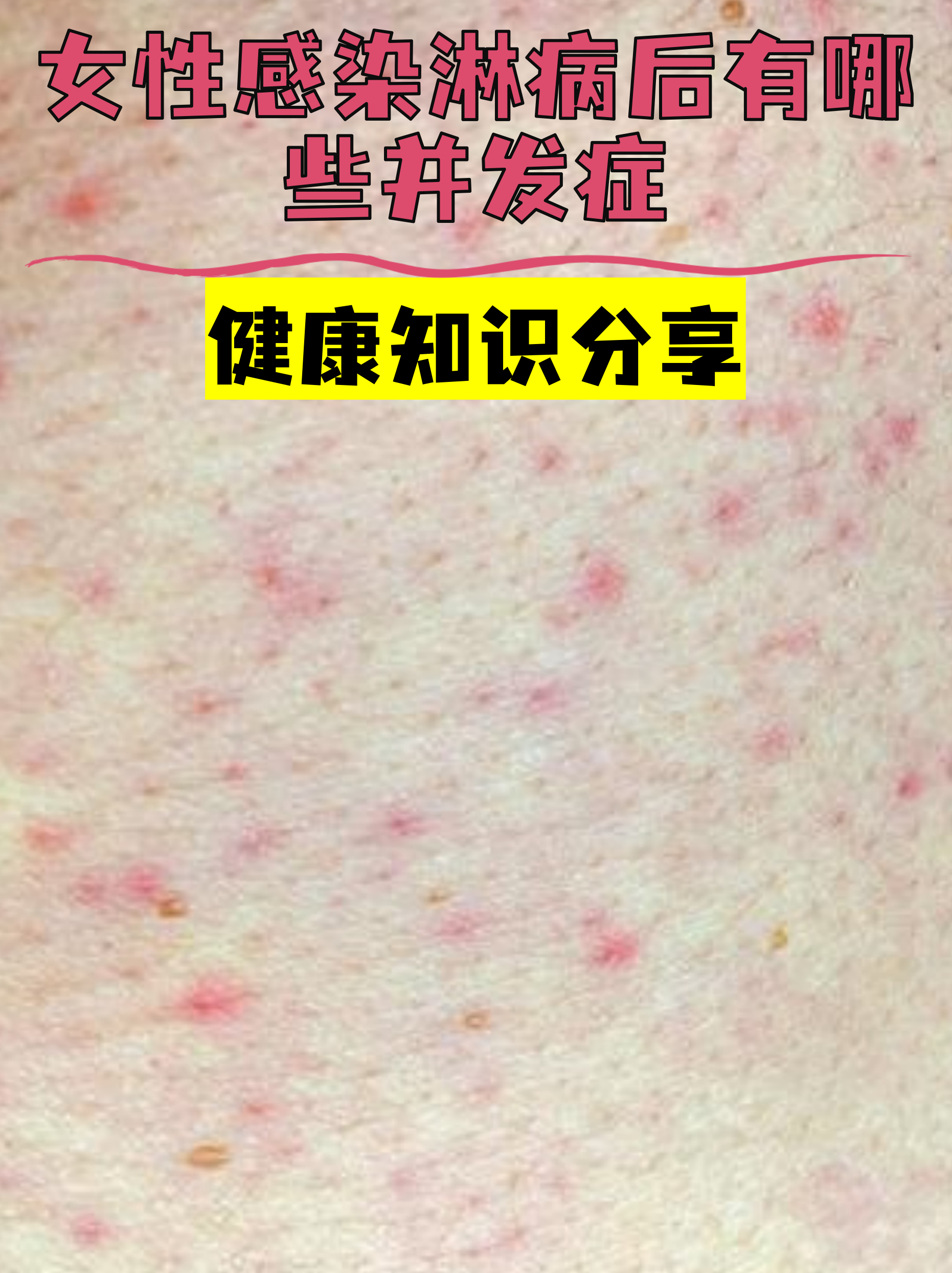 广安门医院代挂专家号服务检验结果异常及时告知，早做处理的简单介绍