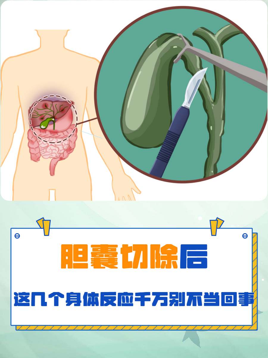 胆囊切除后为什么还会疼