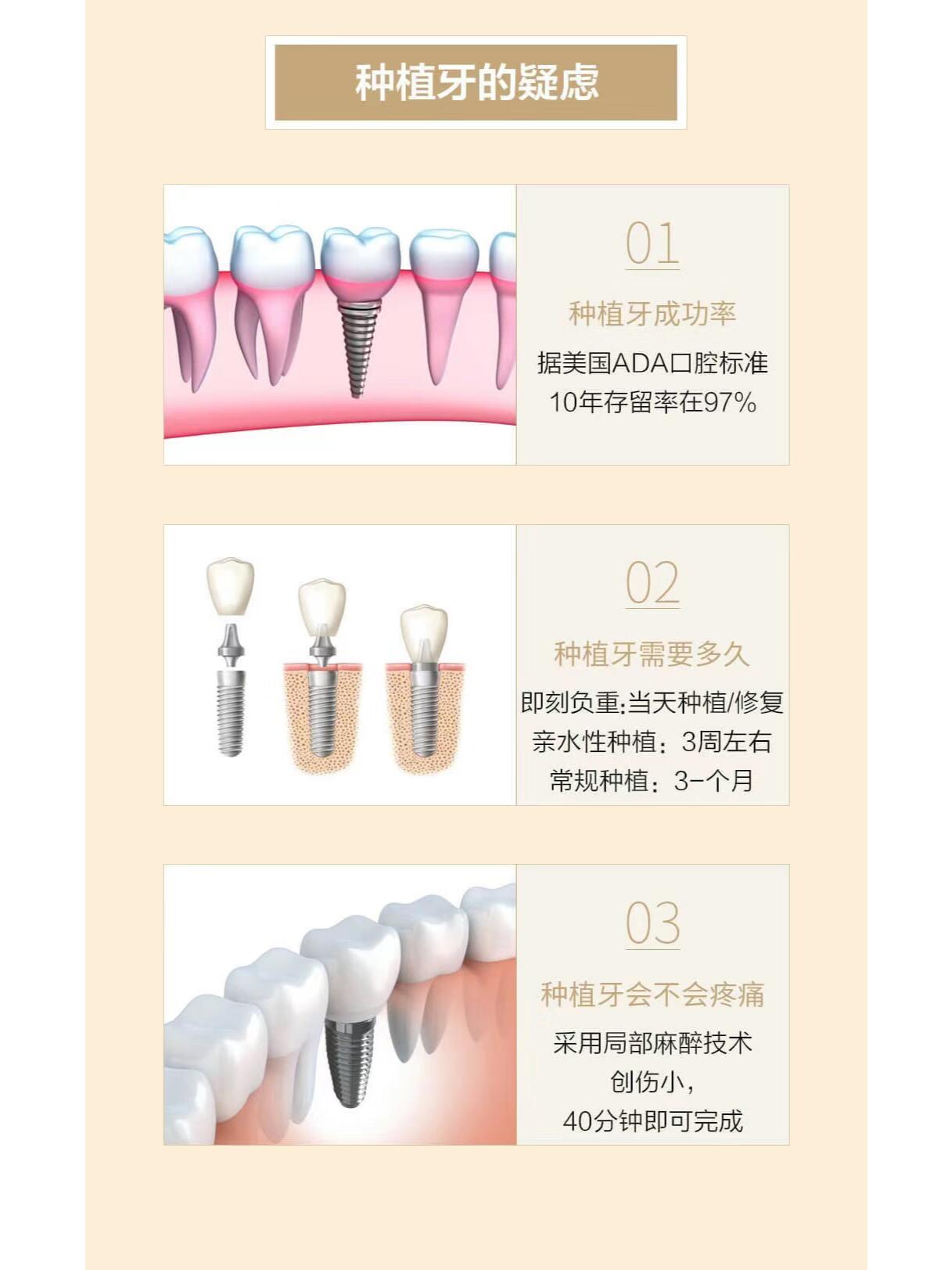 种植牙抖音=抖音种植牙价格