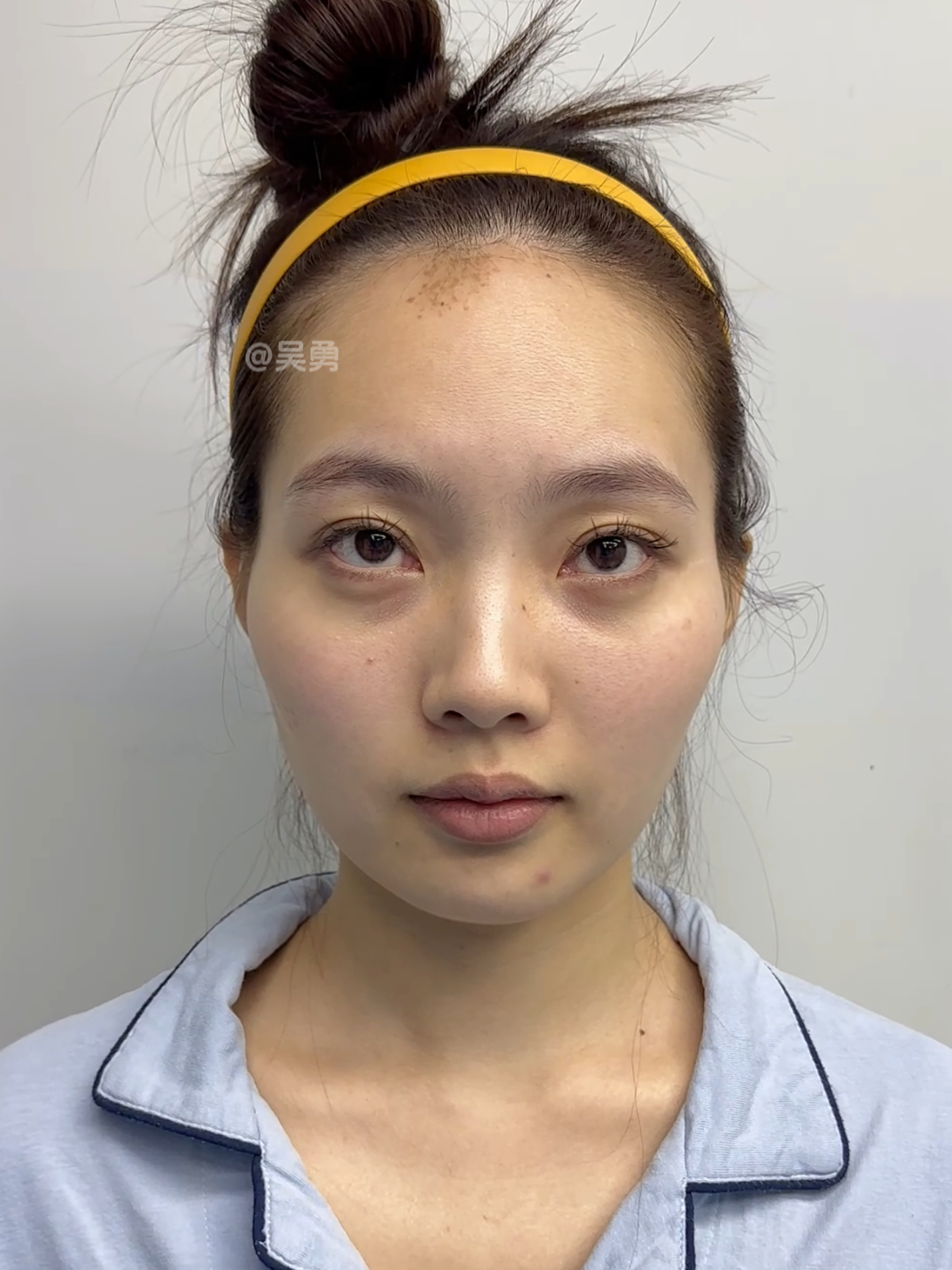 26岁小姐姐,因为颧骨高经常被吐槽"脸大"