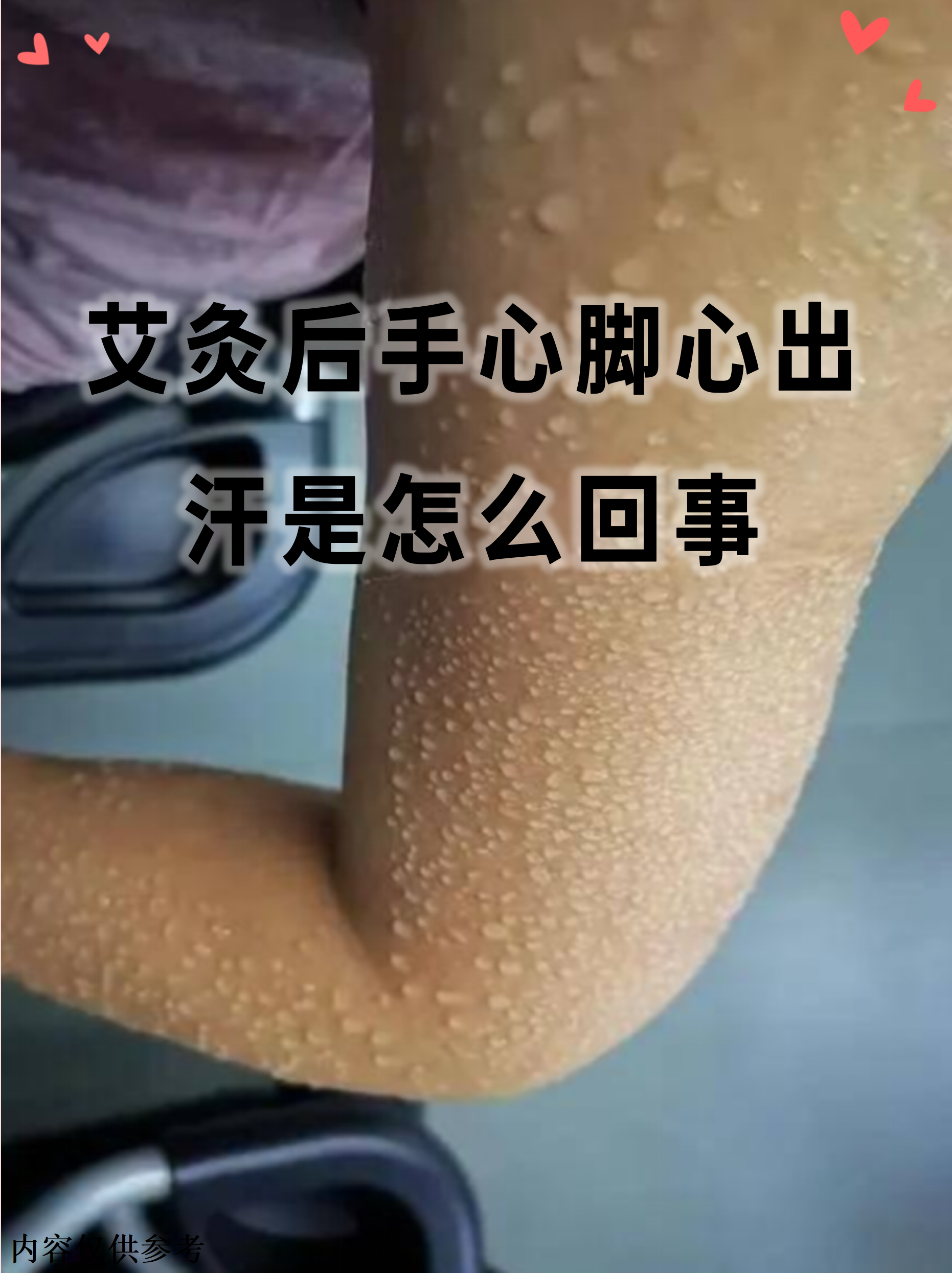 艾灸后手心脚心出汗是怎么回事