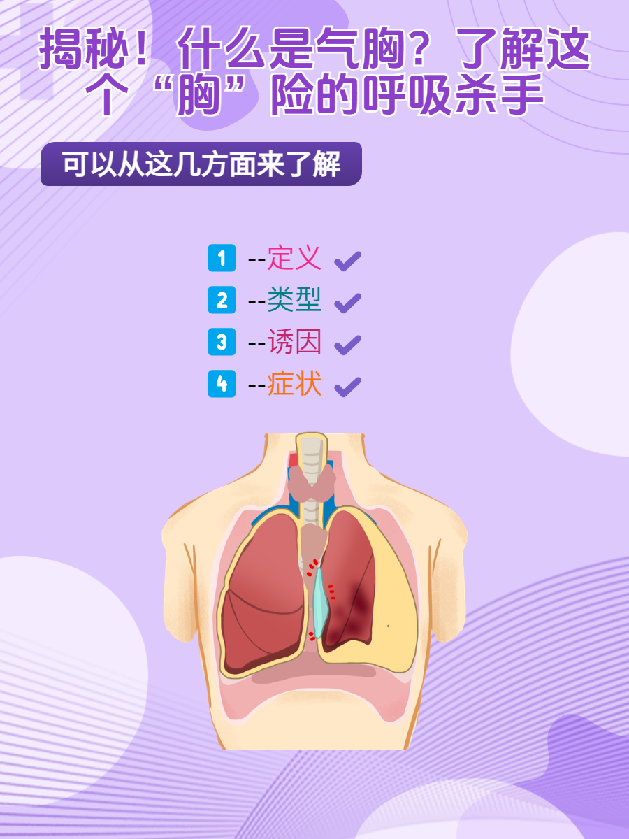 开放性气胸图片解释图片