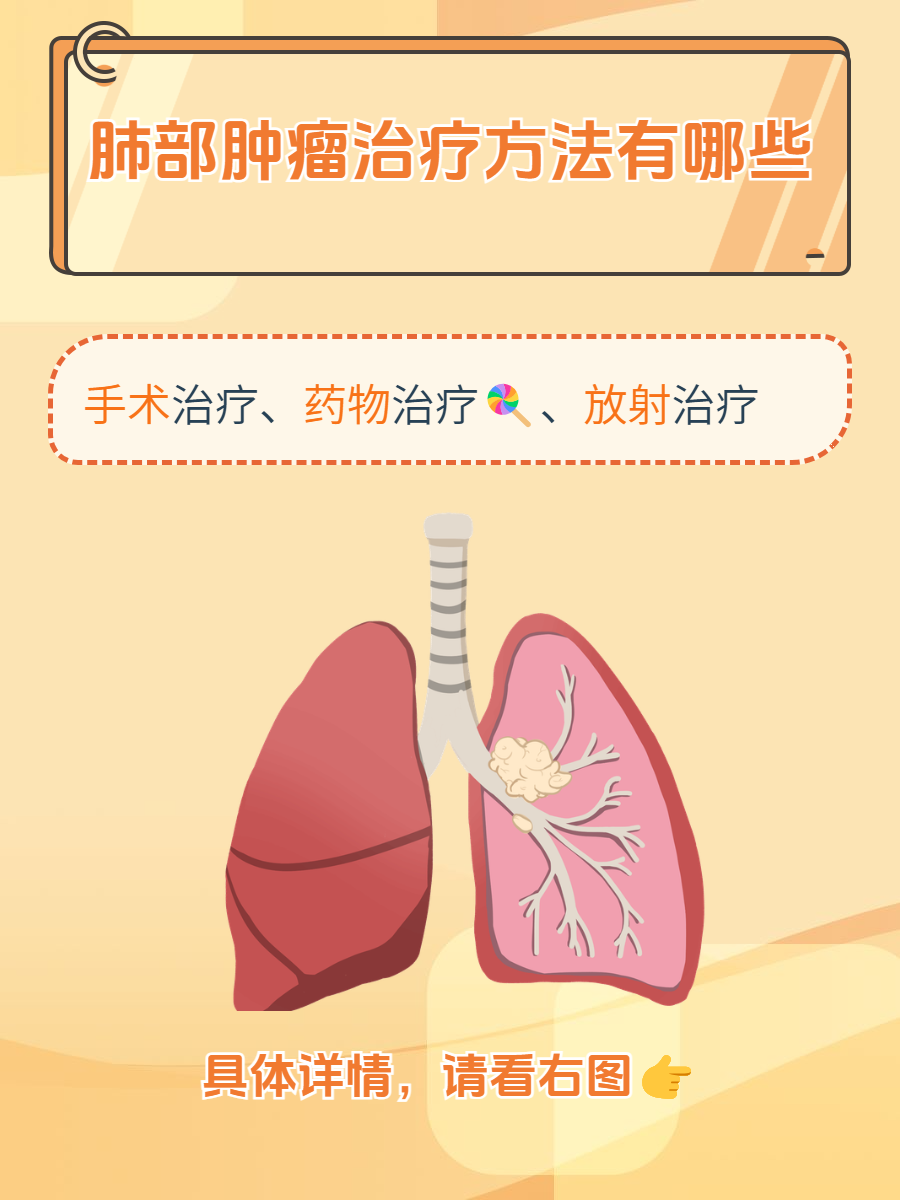 肺部肿瘤治疗方法有哪些?揭开神秘的面纱!