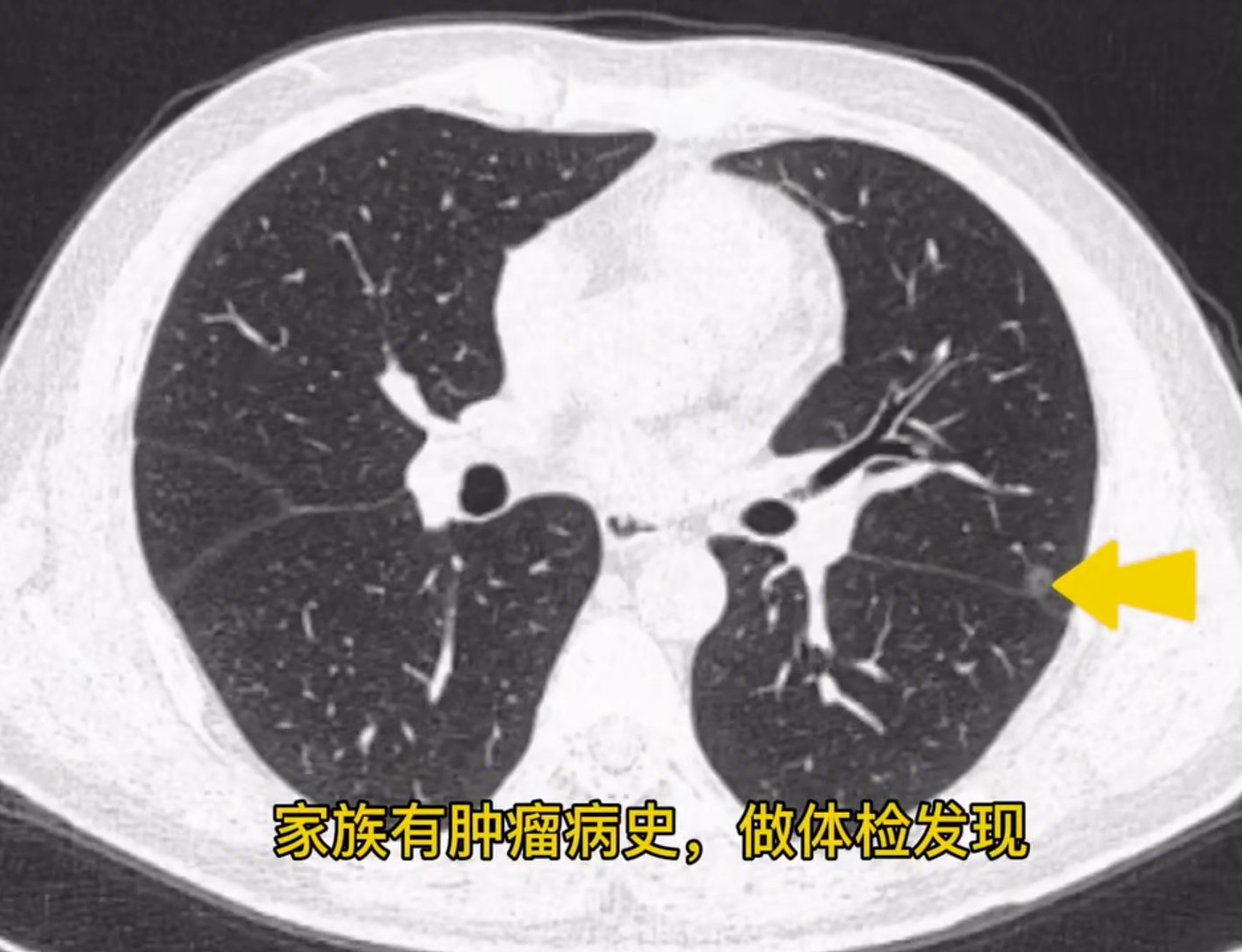 今天早上查房的时候,看到一位病友一脸憔悴,就站在角落那里哭.