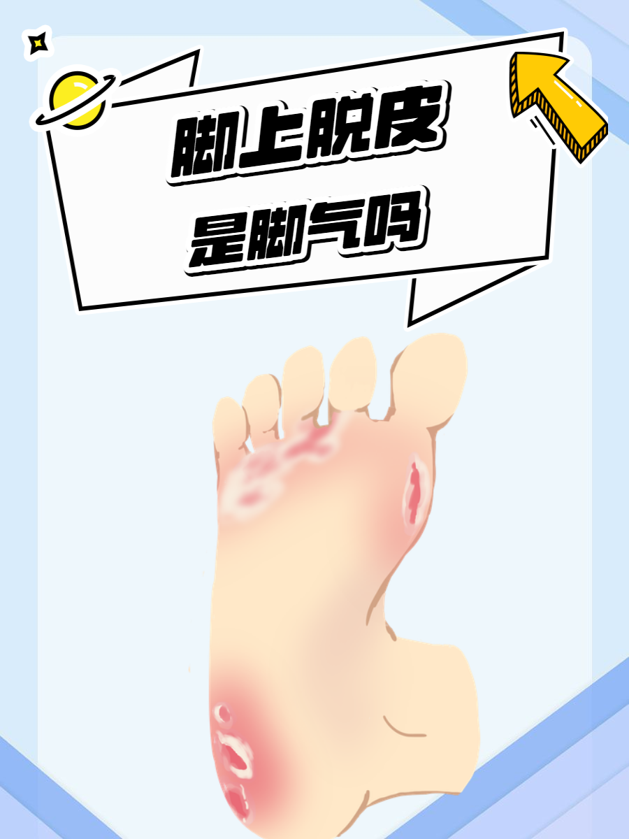 那脚上脱皮可不一定就是脚气,下面我就来给大家好好讲讲