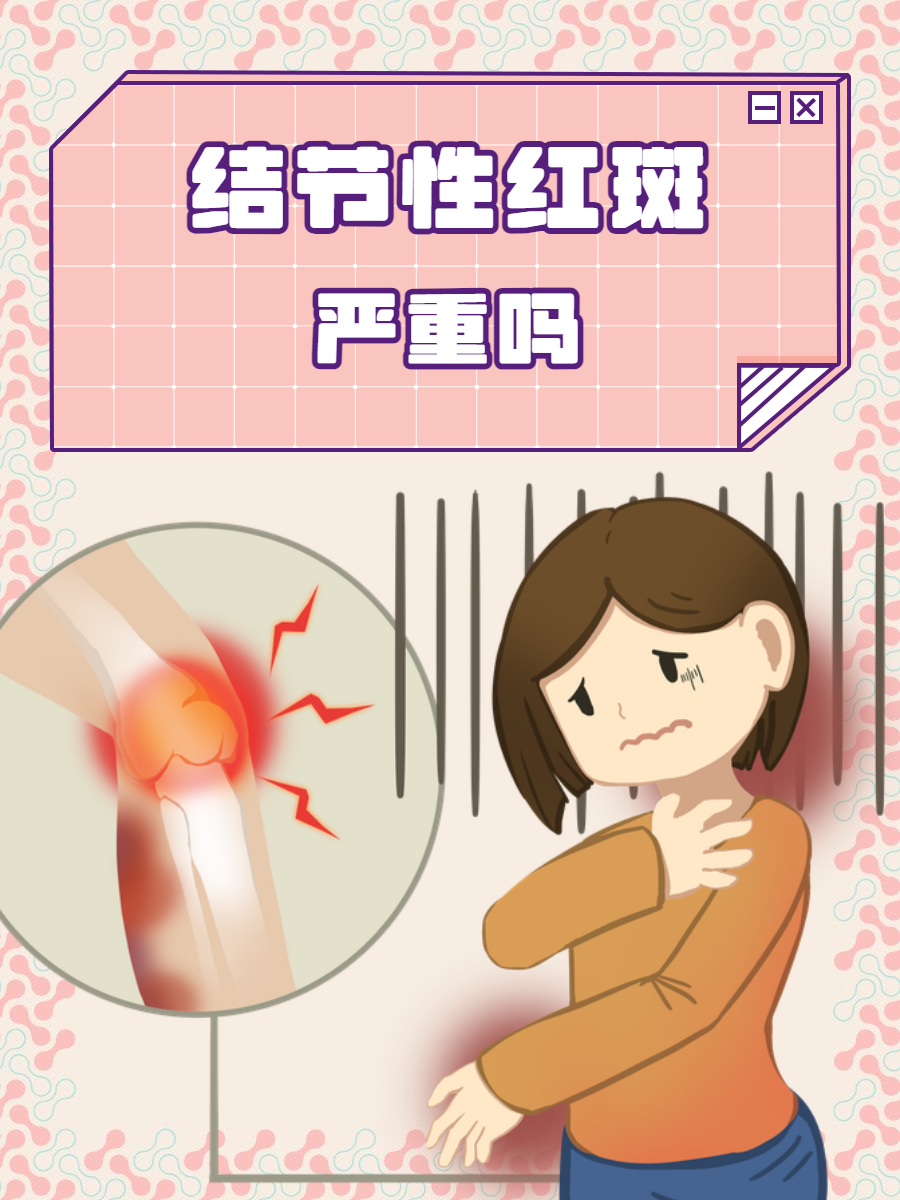 结节性红斑严重吗?