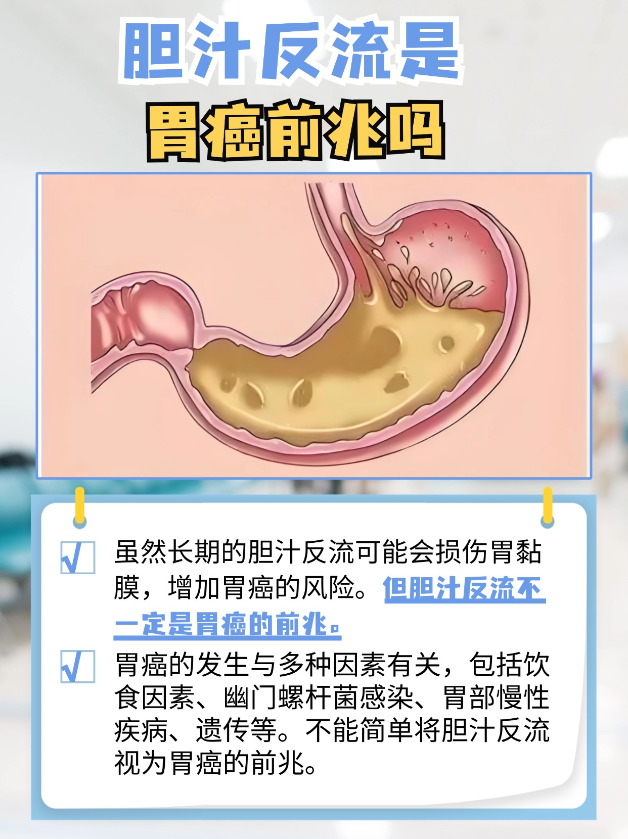 一文说清楚  胆汁反流,又称胆汁性反流性胃炎,是一种比较常见的胃肠道
