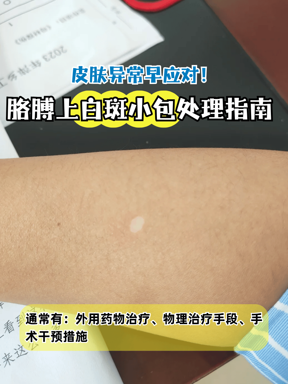 包含307医院代挂专家号服务检验结果异常及时告知,早做处理的词条 包含307医院代挂专家号服务检验结果异常及时告知,早做处理的词条