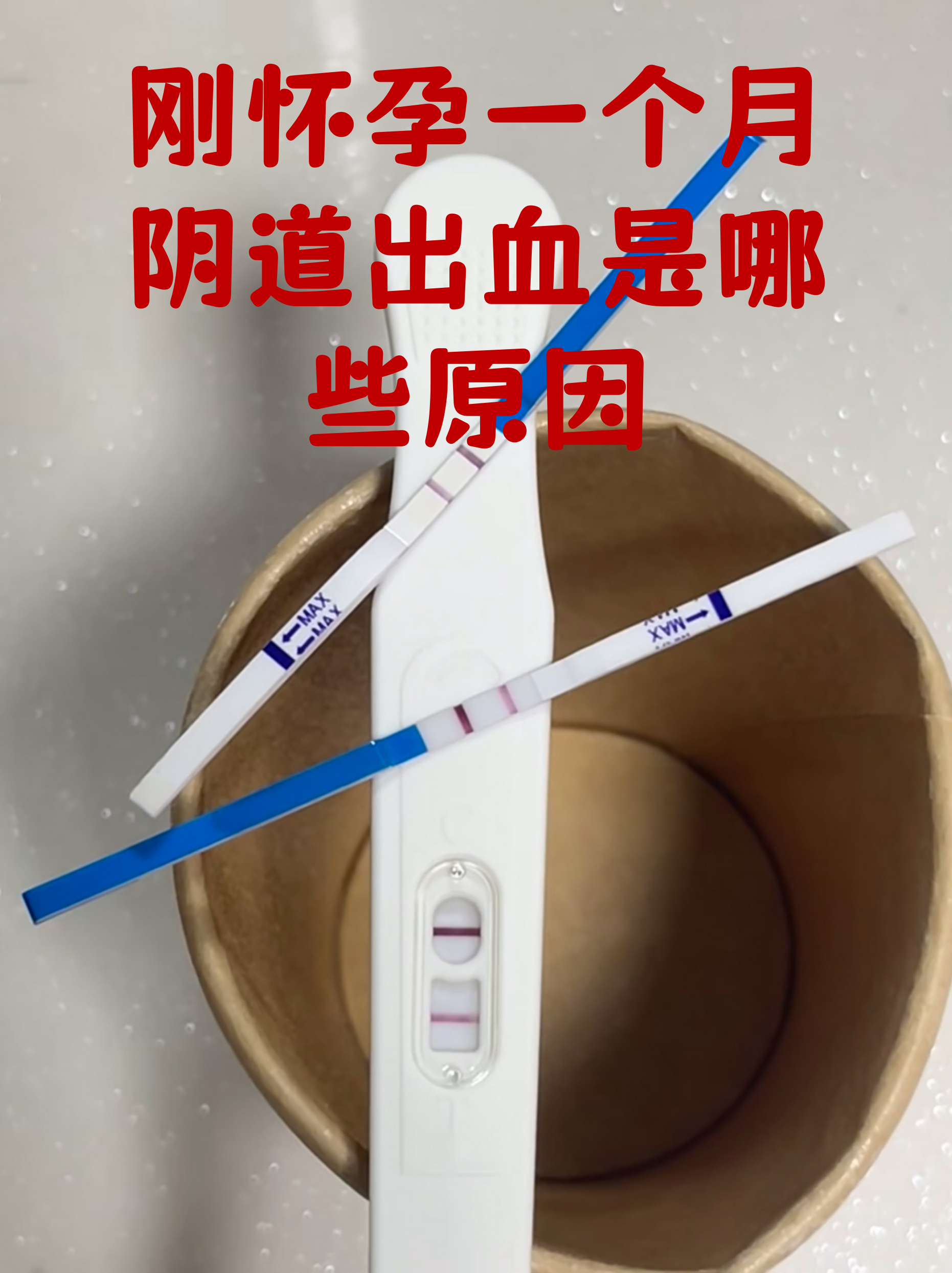 刚怀孕一个月阴道出血是哪些原因