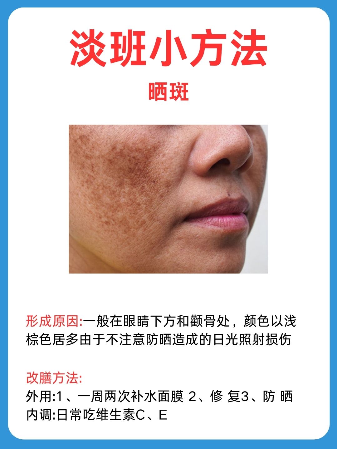 淡斑方法