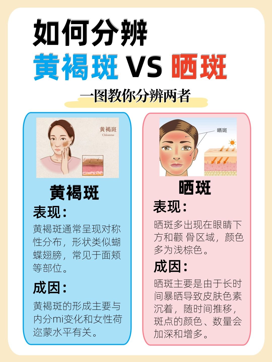 为什么会长黄褐斑