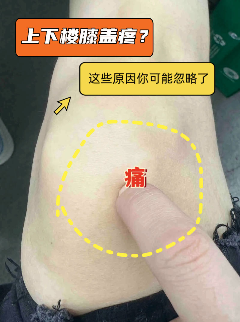 膝盖疼是为什么