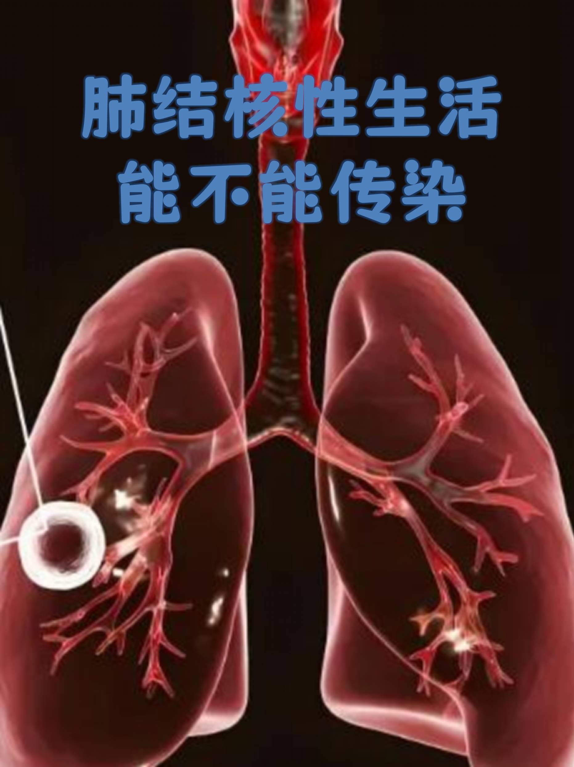 今天我们就来聊聊肺结核与性生活的关联性帮你消除不必要的恐慌