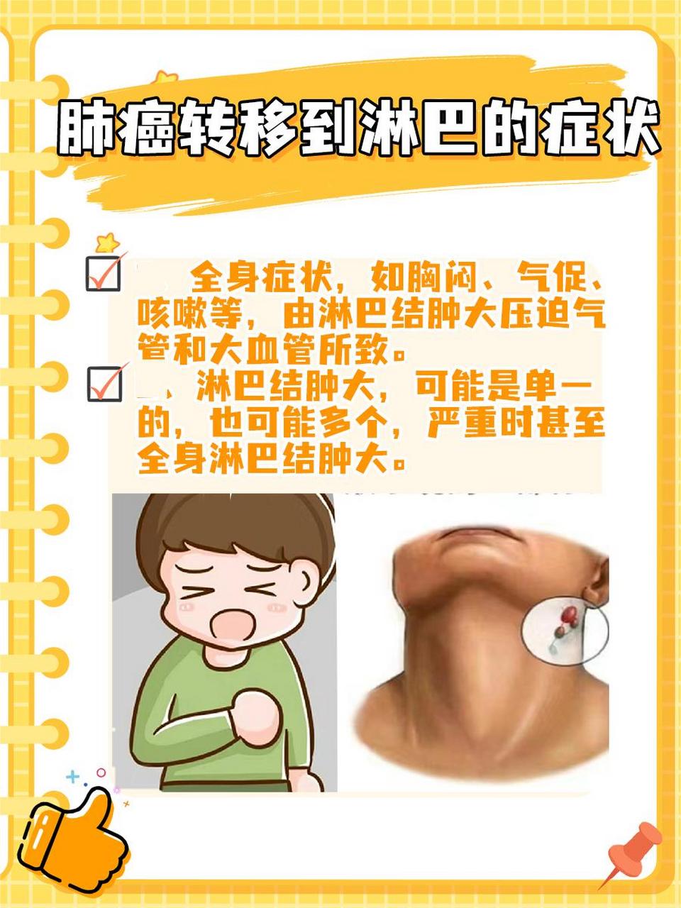 医生坦白局:肺癌转移到淋巴活了10年多见吗?