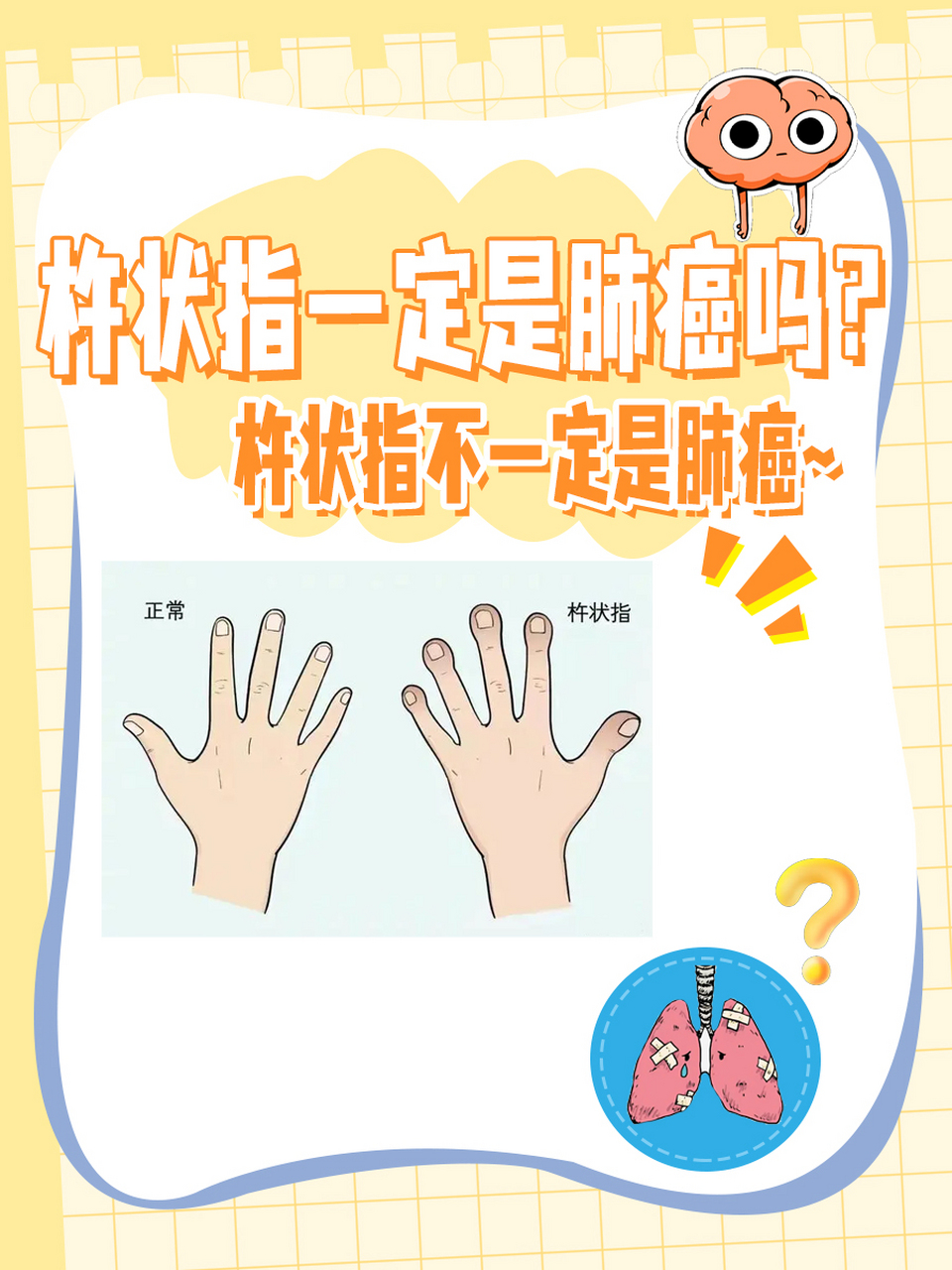 杵状指=肺癌?别慌,真相来啦!