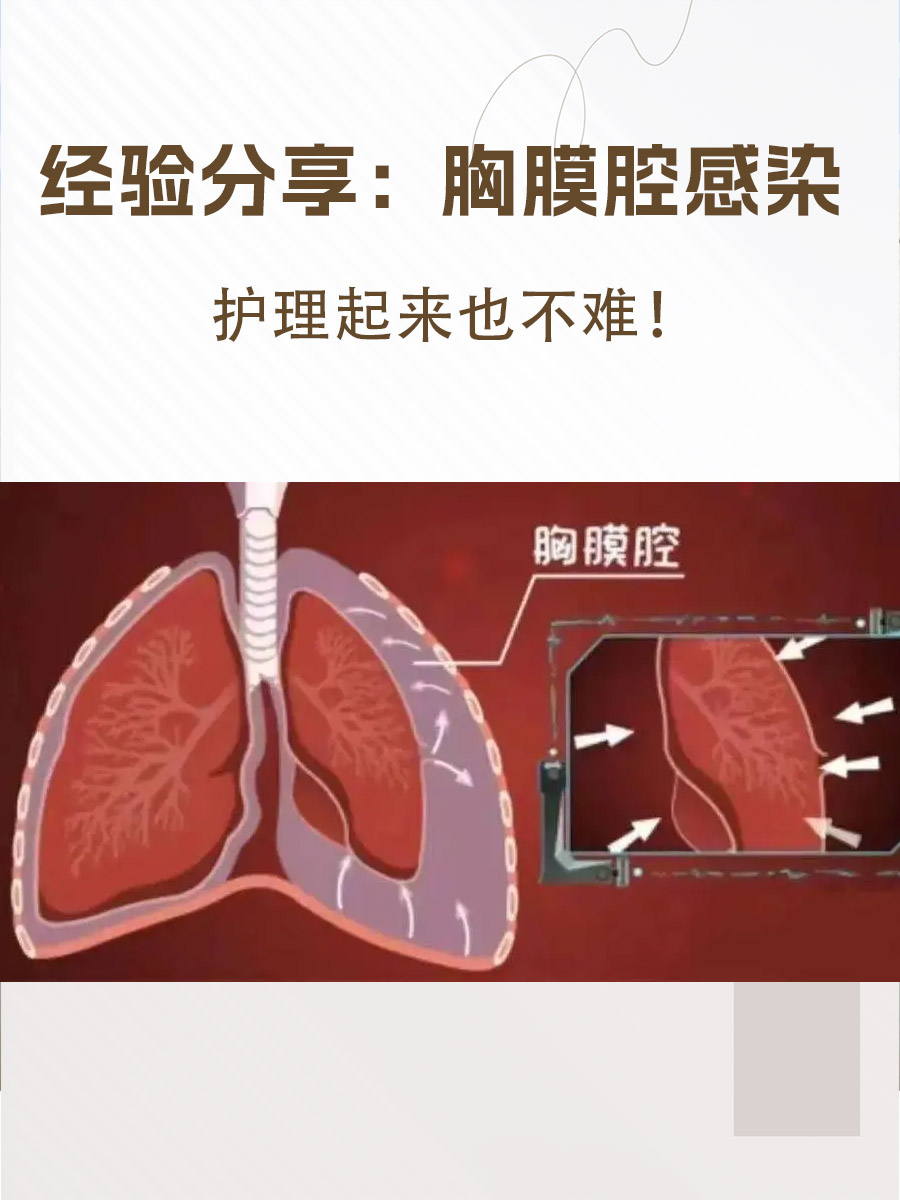 胸膜腔是位于肺表面和胸壁之间的一个潜在空间,正常情况下,这个空间