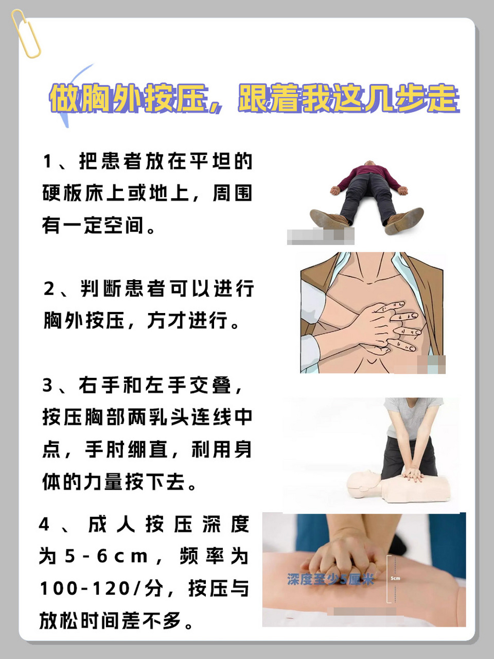 99胸外按压是心肺复苏(cpr)中的一项关键操作,它是在心脏停跳或