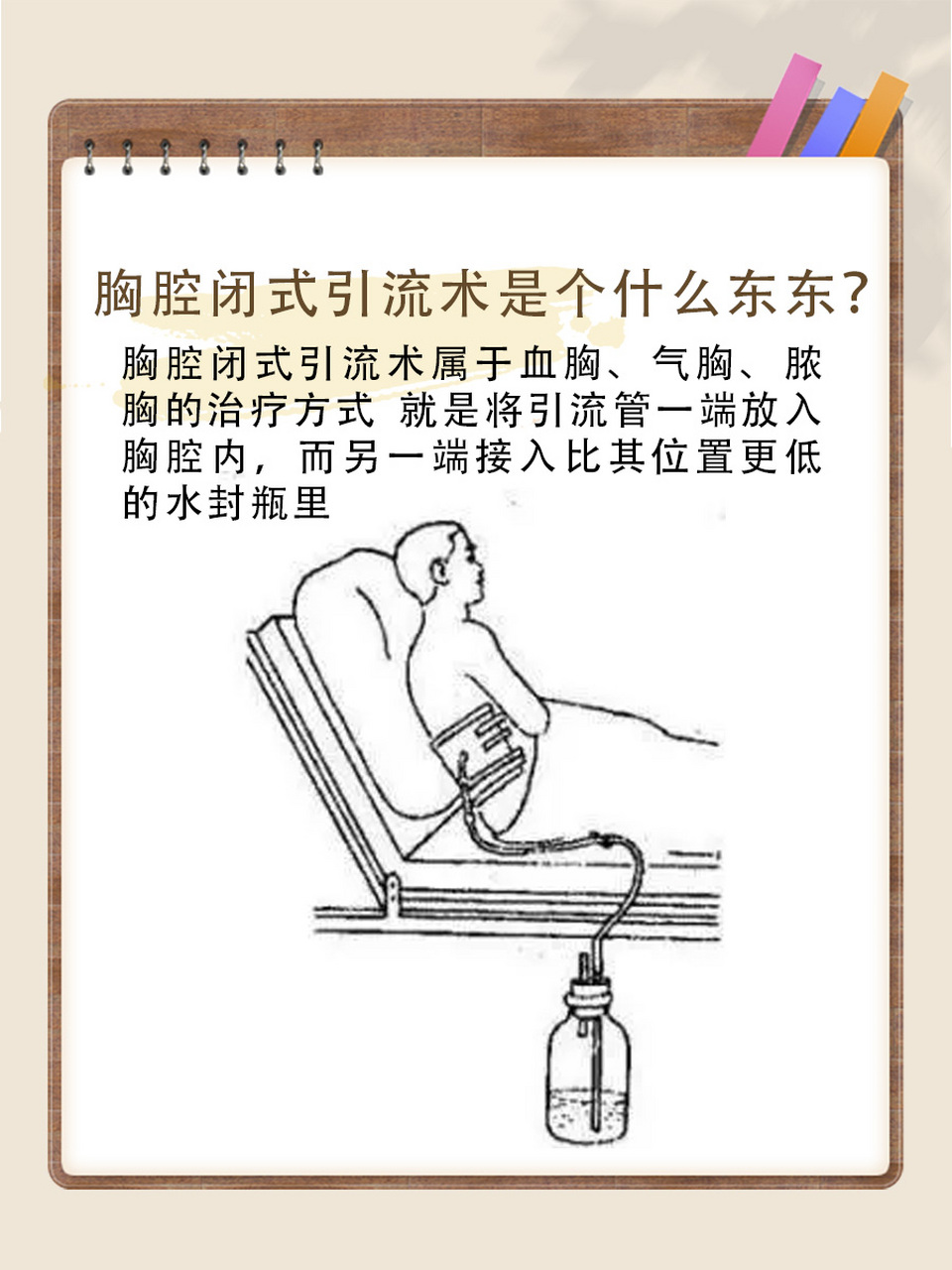 71胸腔闭式引流术知多少?
