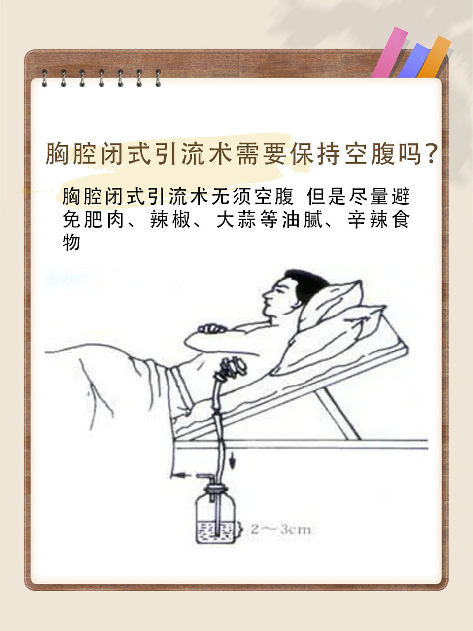 71胸腔闭式引流术知多少?