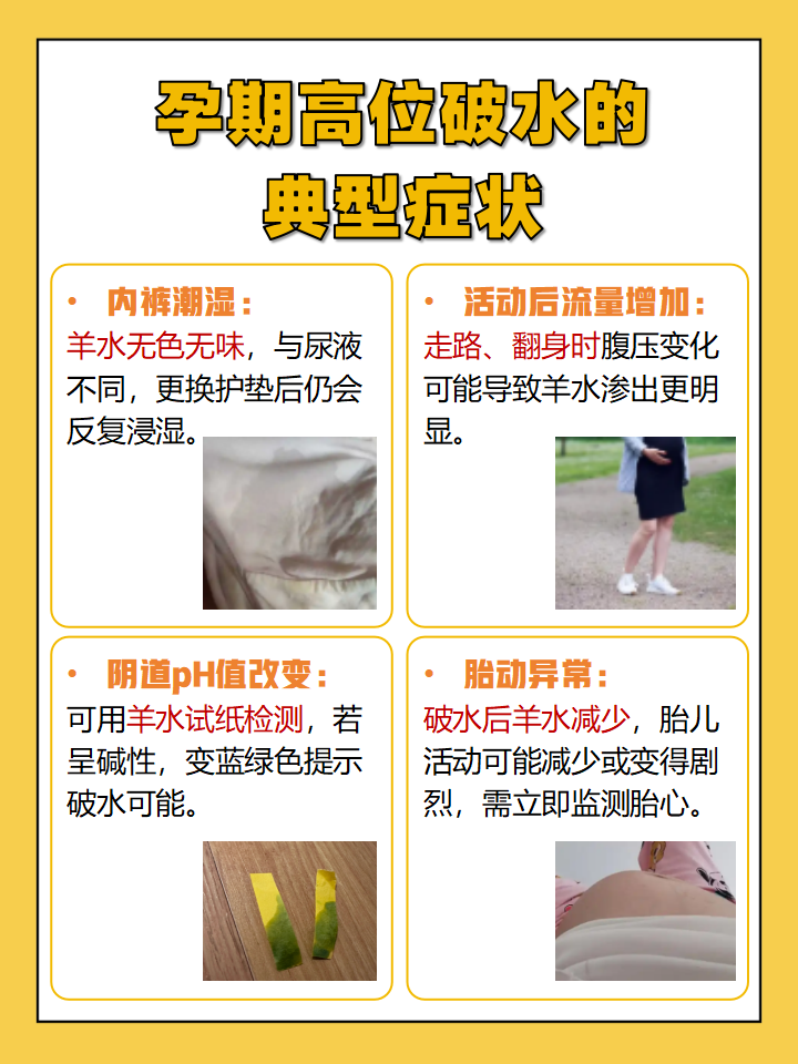 孕晚期突然感觉内裤总是湿湿的,却分不清是漏尿还是破
