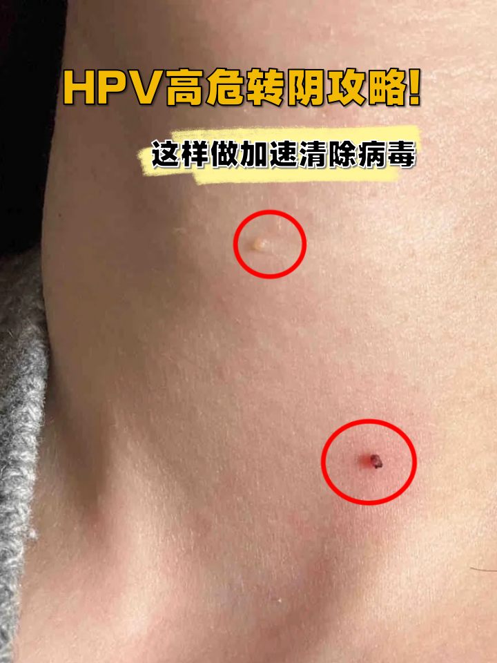 这样做加速清除病毒