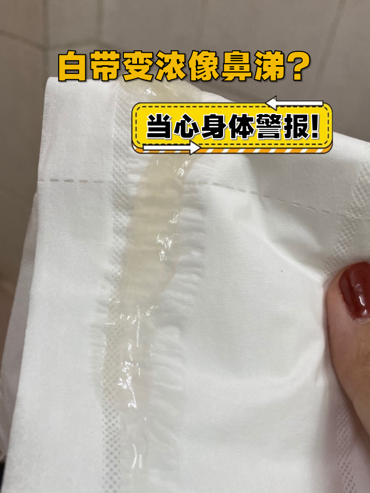 突然发现白带变得浓稠像鼻涕?