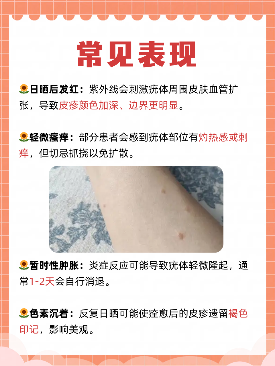 夏天阳光强烈,不少扁平疣患者发现皮疹在日晒后发红发痒,这其实是