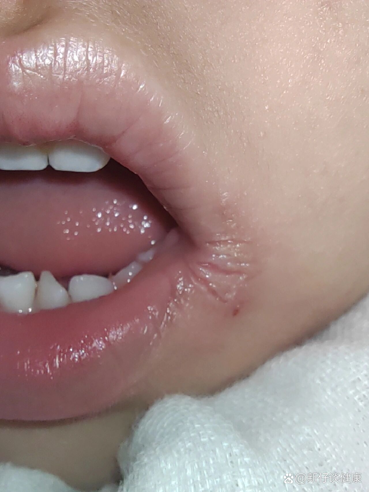 5个最快有效的妙招轻松缓解!