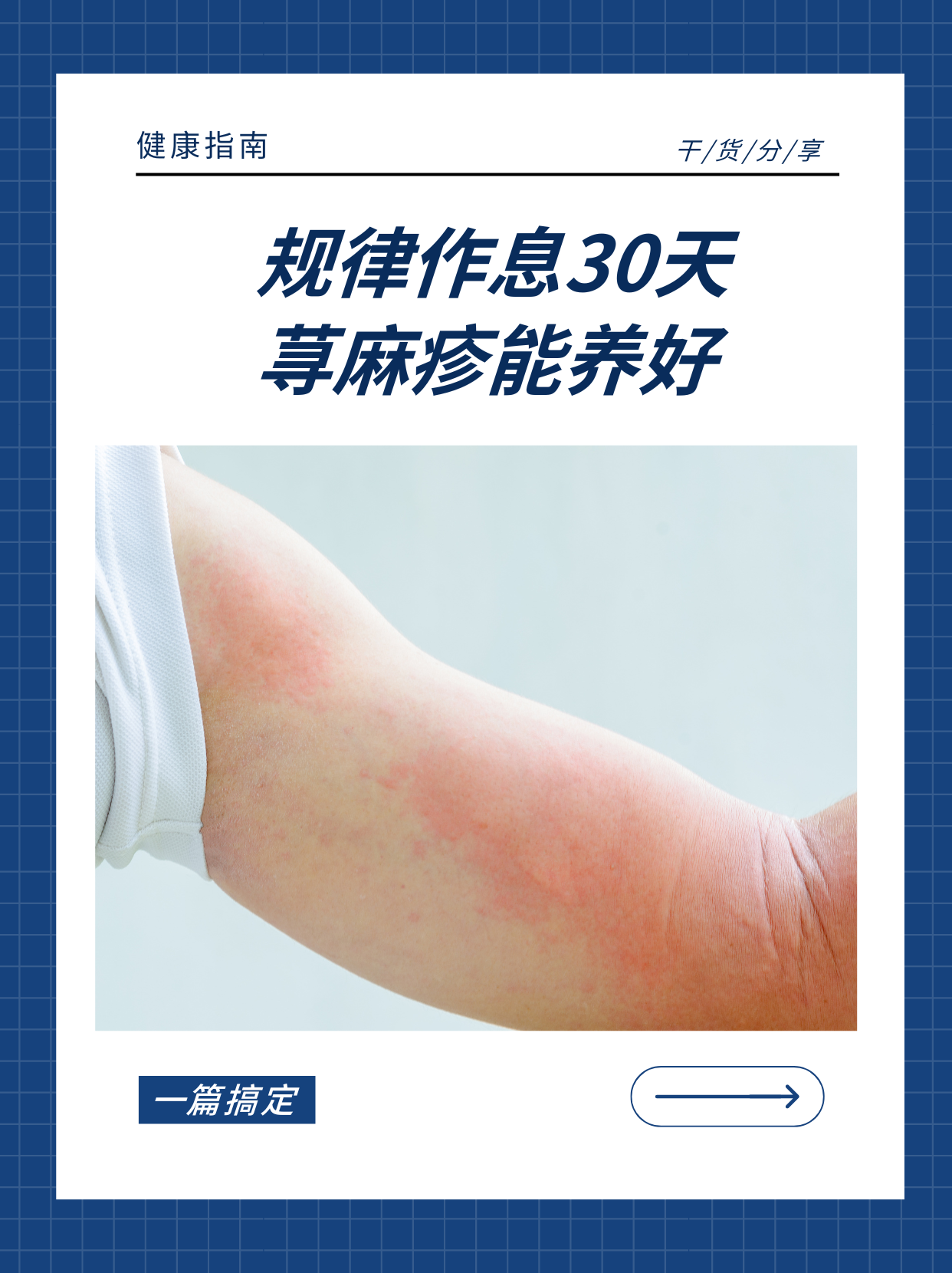 它可能由多种因素引起,如食物过敏,药物反应,感染或心理压力等.