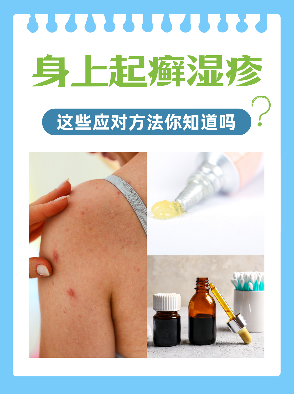 身上起癣湿疹?这些应对方法你知道吗?
