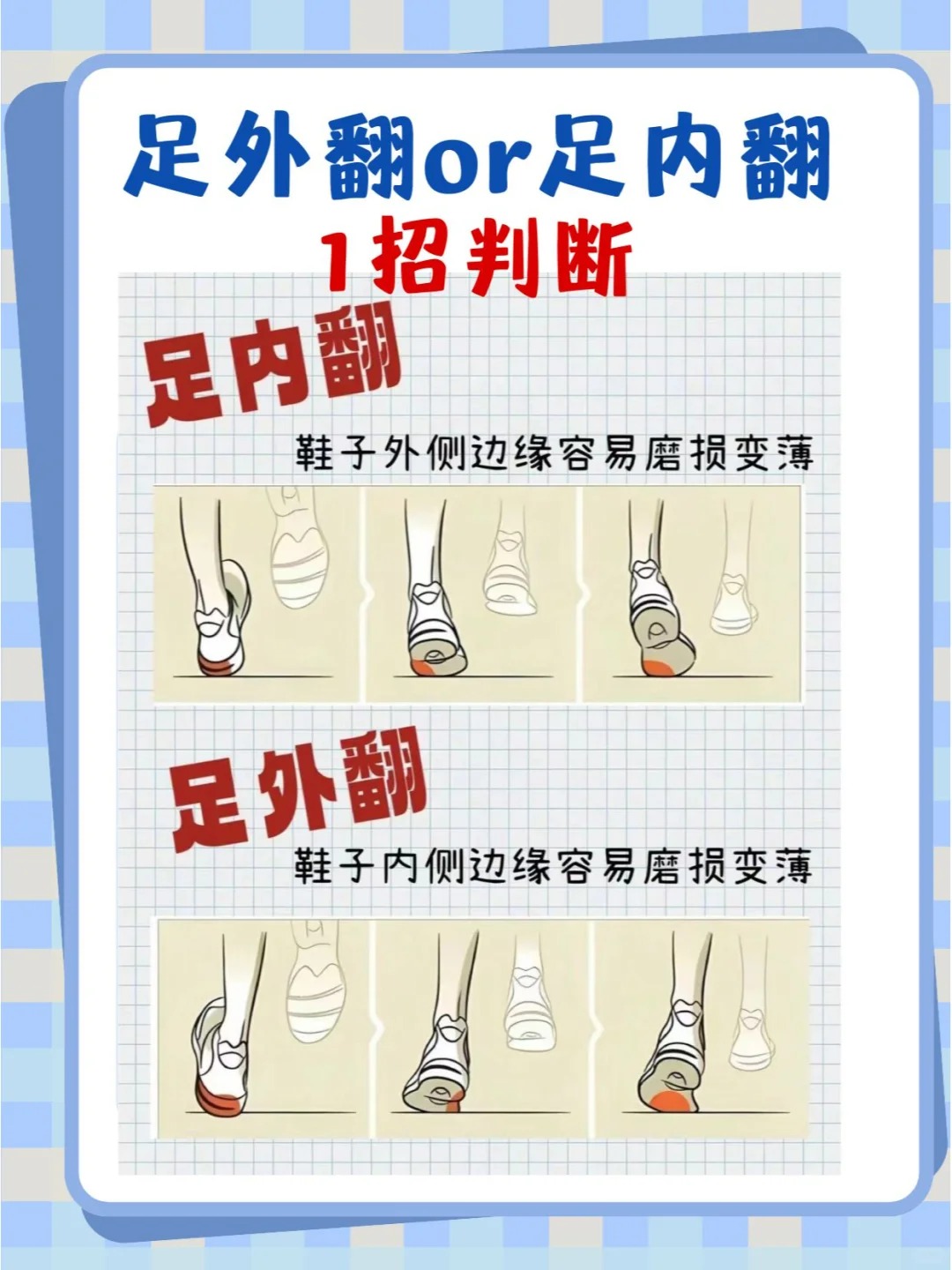 什么是足外翻和足内翻?