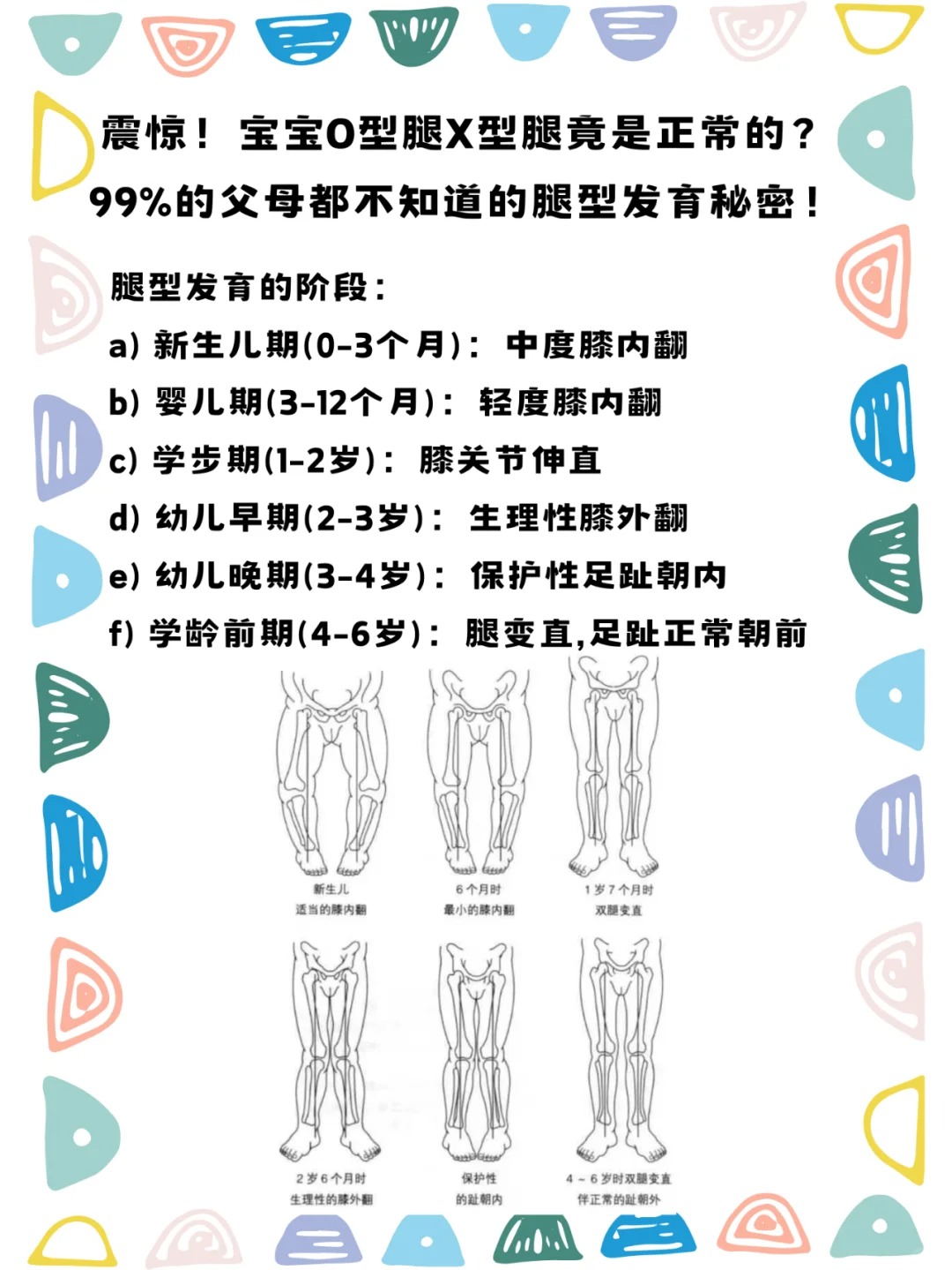 宝宝o型腿x型腿竟是正常的? 什么是婴儿体型发育?