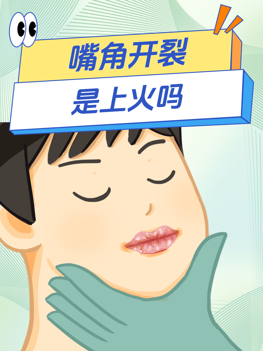 这种状况是上火吗?